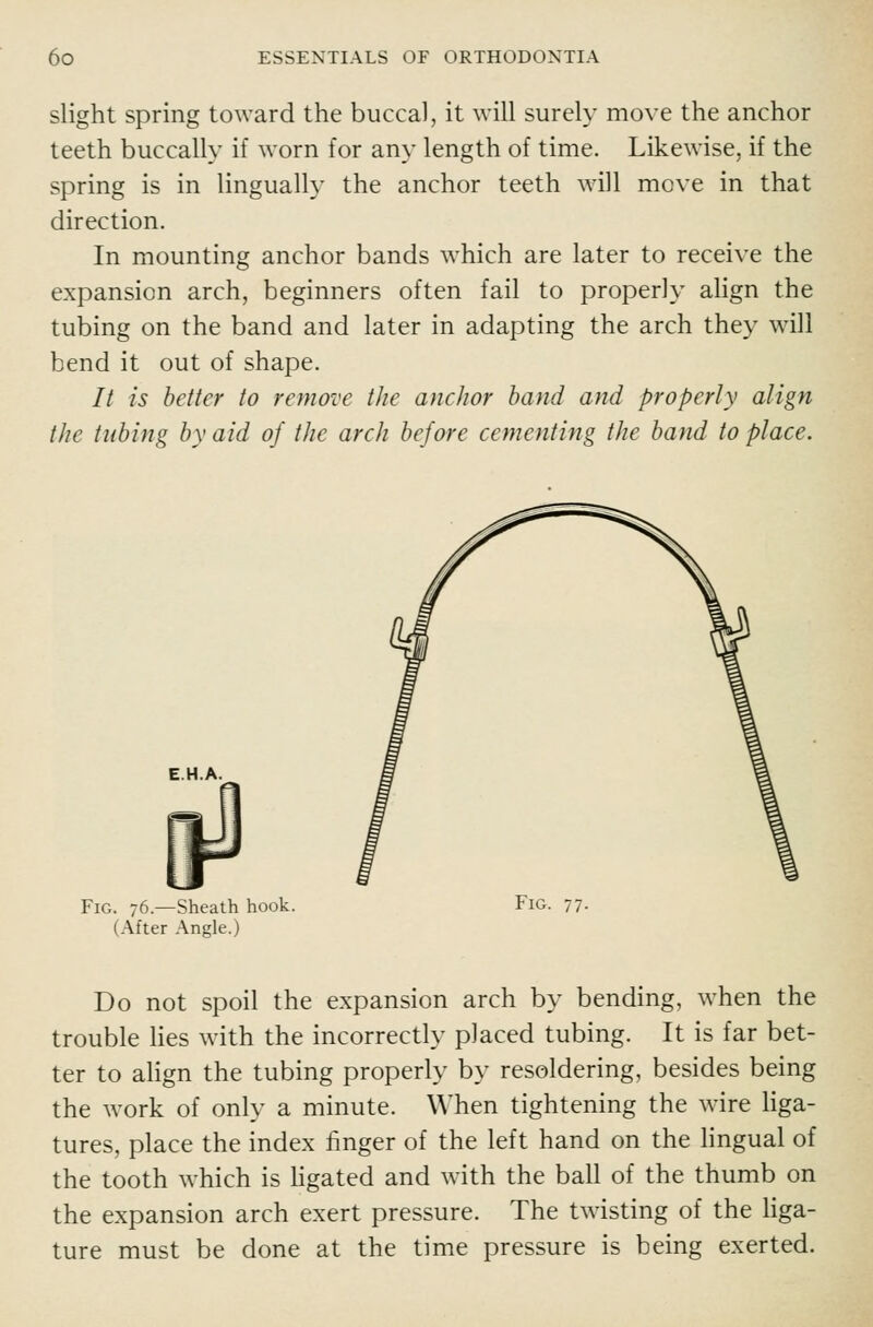 slight spring toward the buccal, it will surely move the anchor teeth buccally if worn for any length of time. Likewise, if the spring is in lingually the anchor teeth will move in that direction. In mounting anchor bands which are later to recei\'e the expansion arch, beginners often fail to properly ahgn the tubing on the band and later in adapting the arch they will bend it out of shape. // is better to remove the anchor band and properly align the tubing by aid of the arch before cementing the band to place. EH.A. Fig. 76.—Sheath hook. Fig. 77. (After Angle.) Do not spoil the expansion arch by bending, when the trouble Hes with the incorrectly placed tubing. It is far bet- ter to align the tubing properly by resoldering, besides being the work of only a minute. When tightening the wire liga- tures, place the index finger of the left hand on the lingual of the tooth which is Hgated and with the ball of the thumb on the expansion arch exert pressure. The twisting of the hga- ture must be done at the time pressure is being exerted.