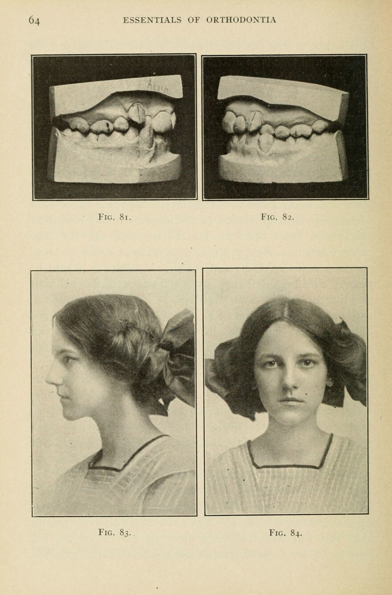 Fig. 8i. Fig. 82.