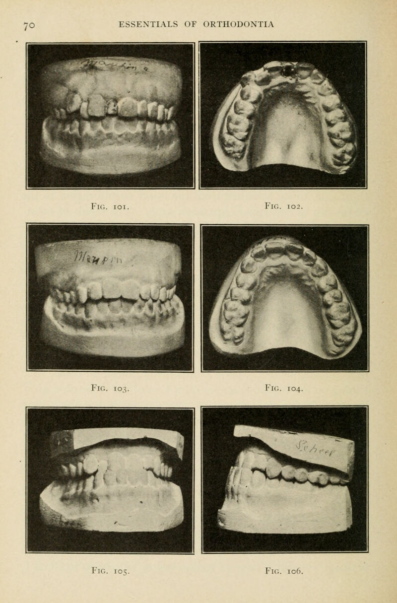 Fig. ioi. Fig. I03 Fig. 103. Fig. 104.