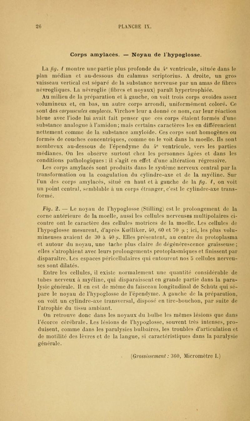 Corps amylacés. — Noyau de l'hypoglosse. I.a .//;/. / montre une partie plus profonde du 4« ventricule, située dans le plan médian ot au-dessous du calamus scriptorius. A droite, un gros vaisseau vertical est séparé de la substance nerveuse par un amas de fibres névrogliques. La névroglie (fibres et noyaux) paraît hypertrophiée. Au milieu de la préparation et à gauche, on voit trois corps ovoïdes assez volumineux et, en bas, un autre corps arrondi, uniformément coloré. Ce sont des corpuscules amylacés. Virchowlcur a donné ce nom, car leur réaction bleue avec l'iode lui avait fait penser que ces corps étaient formés d'une substance analogue à l'amidon; mais certains cai\actères les en différencient nettement comme de la substance amyloïde. Ces corps sont homogènes ou formés de couches concentriques, comme on le voit dans la moelle. Ils sont nombreux au-dessous de Tépendyme du 4 ventricule, vers les parties médianes. On les observe surtout chez les personnes âgées et dans les conditions pathologiques : il s'agit en effet d'une altération régressive. Les corps amylacés sont produits dans le système nerveux central par la transformation ou la coagulation du cylindre-axe et de la myéline. Sur l'un des corps amylacés, situé en haut et à gauche de la fig. /, on voit un point central, semblable à un corps étranger, c'est le cylindre-axe trans- formé. Fig. 2. — Le noyau de l'hypoglosse (Stilling) est le prolongement de la corne antérieure de la moelle, aussi les cellules nerveuses multipolaires ci- contre ont le caractère des cellules motrices de la moelle. Les cellules de l'hypoglosse mesurent, d'après Kœiliker, 40, OO et 70 a ; ici, les plus volu- mineuses avaient de 30 à 40 ;x. Elles piéscntont, au centre du protoplasma et autour du noyau, une tache plus claire de dégénérescence graisseuse ; elles s'atrophient avec leurs prolongements protoplasmiques et finissent par disparaître. Les espaces péricellulaires qui entourent nos 5 cellules nerveu- ses sont dilatés. Entre les cellules, il existe normalement une quantité considérable de tubes nerveux à myéline, qui disparaissent en grande partie dans la para- lysie générale. Il en est de même du faisceau longitudinal de Schiïtz qui sé- pare le noyau de l'hypoglosse de l'épendyme. A gauche de la préparation, on voit un cylindre-axe transversal, disposé en tire-bouchon, par suite de l'atrophie du tissu ambiant. On retrouve donc dans les noyaux du bulbe les mêmes lésions que dans l'écorce cérébrale. Les lésions de l'hypoglosse, souvent très intenses, pro- duisent, comme dans les paralysies bulbaires, les troubles d'articulation et de motilité des lèvres et de la langue, si caractéristiques dans la paralysie générale.