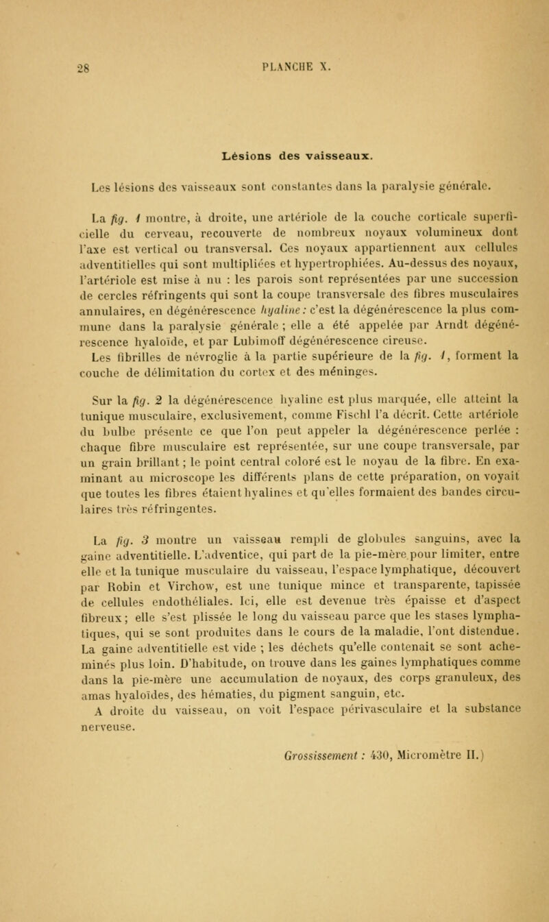 Lésions des vaisseaux. Les lésions des vaisseaux sont cDiislanlcs dans la paralysie générale. La fig. 1 montre, à droite, une arlériolc de la couche corticale superfi- cielle du cerveau, recouverte de nombreux noyaux volumineux dont l'axe est vertical ou transversal. Ces noyaux appartiennent aux cellules adventitielles qui sont multipliées et hypertrophiées. Au-dessus des noyaux, l'artériole est mise à nu : les parois sont représentées par une succession de cercles réfringents qui sont la coupe transversale dos fibres musculaires annulaires, en dégénérescence hyaline: c'est la dégénérescence la plus com- mune dans la paralysie générale ; elle a été appelée par Arndt dégéné- rescence hyaloïde, et par Lubimoff dégénérescence cireuse. Les fibrilles de névroglie à la partie supérieure de la fig. I, forment la couche de délimitation du cortex et des méninges. Sur la fig. 2 la dégénérescence liyalinc est plus marquée, elle atteint la tunique musculaire, exclusivement, comme Fischl l'a décrit. Cette artériole du bulbe présente ce que l'on peut appeler la dégénérescence perlée : chaque fibre musculaire est représentée, sur une coupe transversale, par un grain brillant ; le point central coloré est le noyau de la fibre. En exa- minant au microscope les différents plans de cette préparation, on voyait que toutes les fibres étaient hyalines et qu'elles formaient des bandes circu- laires très réfringentes. La //y. 3 montre un vaisseau rempli de globules sanguins, avec la gaine adventitielle. L'adventice, qui part de la pie-mère pour limiter, entre elle et la tunique musculaire du vaisseau, l'espace lymphatique, découvert par Robin et Virchow, est une tunique mince et transparente, tapissée de cellules endothéliales. Ici, elle est devenue très épaisse et d'aspect fibreux ; elle s'est plissée le long du vaisseau parce que les stases lympha- tiques, qui se sont produites dans le cours de la maladie, l'ont distendue. La gaine ailventitiellc est vide ; les déchets qu'elle contenait se sont ache- minés plus loin. D'habitude, on trouve dans les gaines lymphatiques comme dans la pie-mère une accumulation de noyaux, des corps granuleux, des amas hyaloïdes, des hématies, du pigment sanguin, etc. A droite du vaisseau, on voit l'espace périvasculaire et la substance nerveuse.