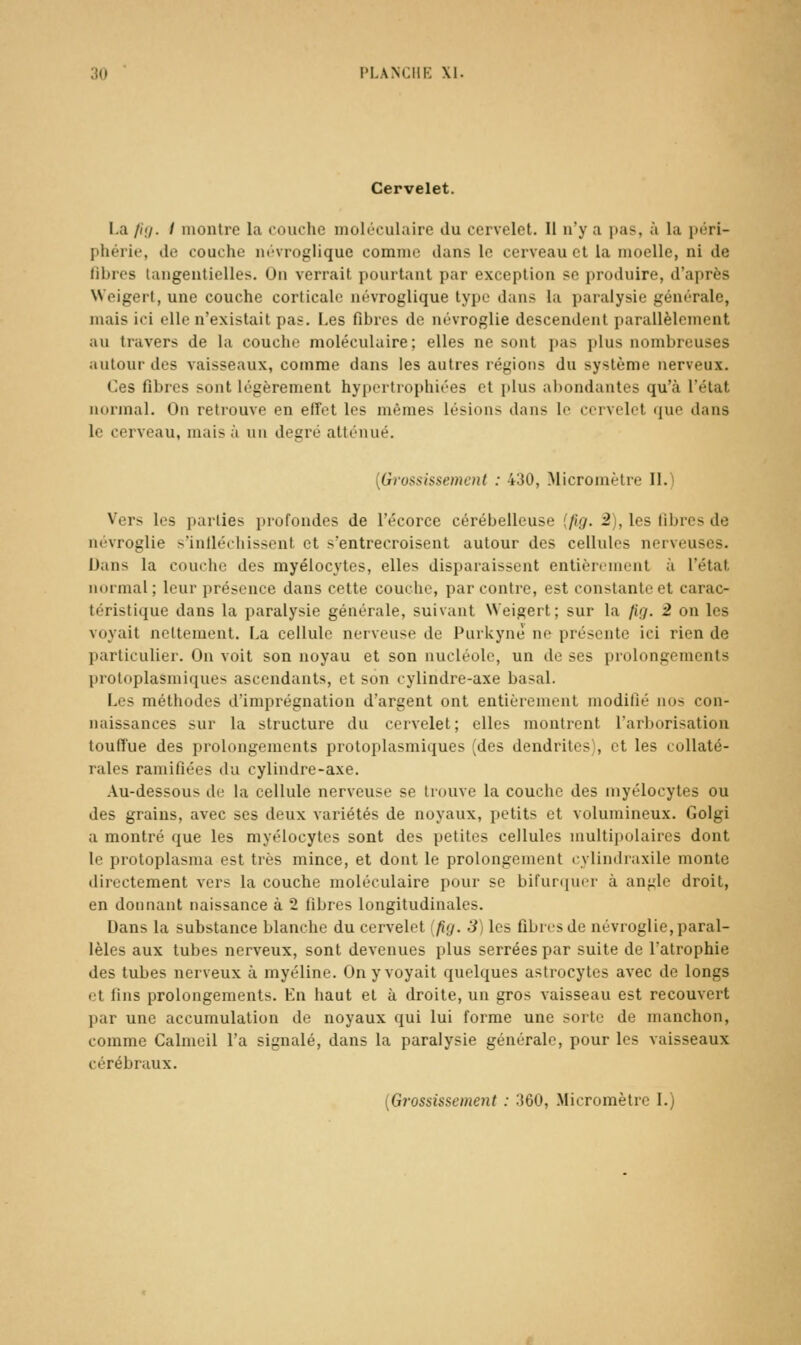 Cervelet. La fi<j. I montre la couche moléculaire du cervelet. Il n'y a pas, à la péri- phérie, de couche névroglique comme dans le cerveau et la moelle, ni de fibres langentielles. On verrait pourtant par exception se produire, d'après Weigert, une couche corticale névroglique type dans la paralysie générale, mais ici elle n'existait pas. I,es fibres de névroglie descendent parallèlement au travers de la couche moléculaire; elles ne sont pas plus nombreuses autour des vaisseaux, comme dans les autres régions du système nerveux. Ces fibres sont légèrement hypertrophiées et plus abondantes qu'à l'état normal. On retrouve en effet les mêmes lésions dans le cervelet (jue dans le cerveau, mais à un degré atténué. {Gi'ossissement : 430, Micromètre II.! Vers les parties profondes de l'écorce cérébelleuse {fig. 2), les fibres de névroglie s'inlléchissent et s'entrecroisent autour des cellules nerveuses. Dans la couche des myélocytes, elles disparaissent entièrement à l'état normal ; leur présence dans cette couche, par contre, est constante et carac- téristique dans la paralysie générale, suivant Weigert; sur la fig. 2 on les voyait nettement. La cellule nerveuse de Purkyne ne présente ici rien de particulier. On voit son noyau et son nucléole, un de ses prolongements proloplasiuiques ascendants, et son cylindre-axe basai. Les méthodes d'imprégnation d'argent ont entièrement modifié nos con- naissances sur la structure du cervelet; elles montrent l'arltorisation touffue des prolongements protoplasmiques (des dendrites), et les collaté- rales ramifiées du cylindre-axe. Au-dessous de la cellule nerveuse se trouve la couche des myélocytes ou des grains, avec ses deux variétés de noyaux, petits et volumineux. Golgi a montré que les myélocytes sont des petites cellules multipolaires dont le protoplasma est très mince, et dont le prolongement cylindraxile monte directement vers la couche moléculaire pour se bifurquer à angle droit, en donnant naissance à 2 fibres longitudinales. Dans la substance blanche du cervelet (fig. 3) les fibres de névroglie, paral- lèles aux tubes nerveux, sont devenues plus serrées par suite de l'atrophie des tubes nerveux à myéline. On y voyait quelques astrocytes avec de longs et fins prolongements. En haut et à droite, un gros vaisseau est recouvert par une accumulation de noyaux qui lui forme une sorte de manchon, comme Calmeil l'a signalé, dans la paralysie générale, pour les vaisseaux cérébraux.