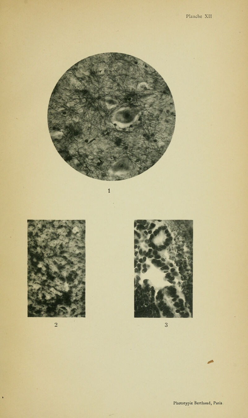 2^^^ Phototypie Berthaud, Paris.