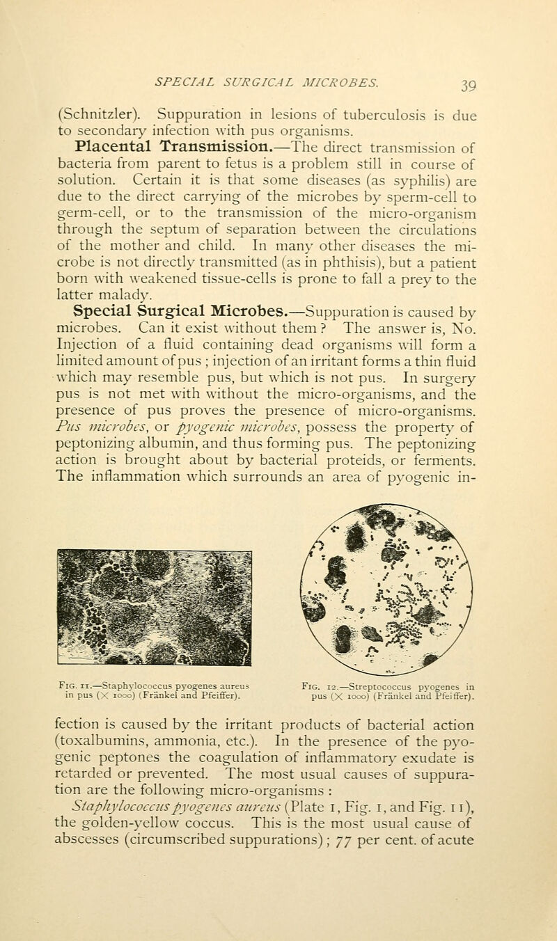 SPECIAL SURGICAL MICROBES. (Schnitzler). Suppuration in lesions of tuberculosis is due to secondar)^ infection with pus organisms. Placental Transmission.—The direct transmission of bacteria from parent to fetus is a problem still in course of solution. Certain it is that some diseases (as syphilis) are due to the direct carr\-ing of the microbes by sperm-cell to germ-cell, or to the transmission of the micro-organism through the septum of separation between the circulations of the mother and child. In many other diseases the mi- crobe is not directly transmitted (as in phthisis), but a patient born with weakened tissue-cells is prone to fall a prey to the latter malady. Special Surgical Microbes.—Suppuration is caused by microbes. Can it exist without them ? The answer is, No. Injection of a fluid containing dead organisms will form a limited amount of pus ; injection of an irritant forms a thin fluid which may resemble pus, but which is not pus. In surgery pus is not met with without the micro-organisms, and the presence of pus proves the presence of micro-organisms. Pus uiicrobt's, or pyogenic inici-obcs, possess the propert}' of peptonizing albumin, and thus forming pus. The peptonizing action is brought about by bacterial proteids, or ferments. The inflammation which surrounds an area of pyogenic in- FiG. II.—Staphylococcus pyogenes aureus in pus (X looo) (Frankel and Pfeiffer). Fig. 12.—Streptococcus pyogenes in pus (X looo) (Frankel and Pfeiffer). fection is caused by the irritant products of bacterial action (toxalbumins, ammonia, etc.). In the presence of the pyo- genic peptones the coagulation of inflammator}' exudate is retarded or prevented. The most usual causes of suppura- tion are the following micro-organisms : Staphylococcuspyogaus aureus (Plate I, Fig. I, and Fig. 11), the golden-yellow coccus. This is the most usual cause of abscesses (circumscribed suppurations); yy per cent, of acute