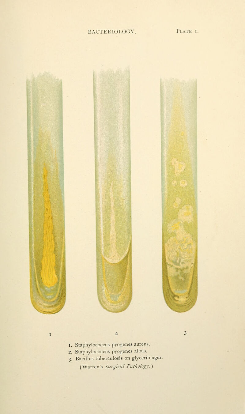 1. Staphylococcus pyogenes aureus. 2. Staphylococcus pyogenes albus. 3. Bacillus tuberculosis on glycerin-agar. (Warren's Surgical Pathology.)