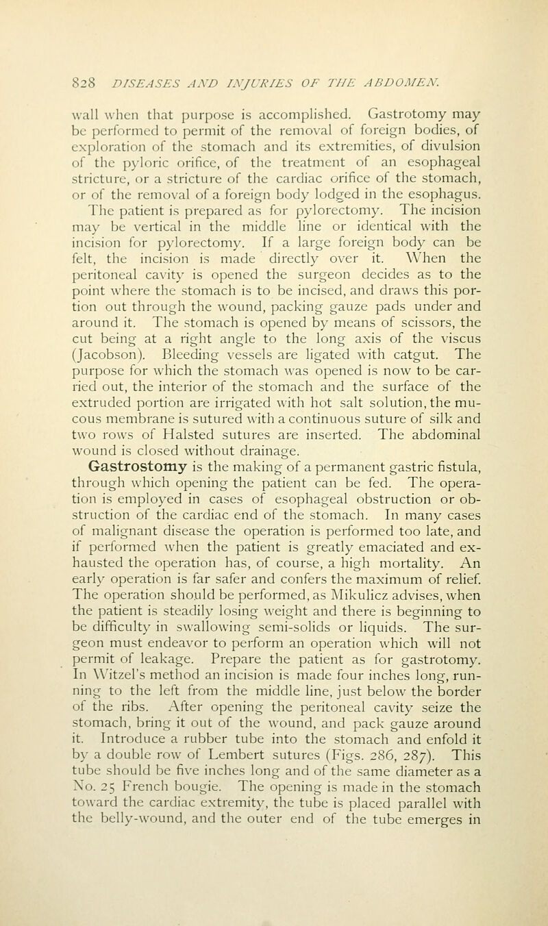 wall when that purpose is accomplished. Gastrotomy may- be performed to permit of the removal of foreign bodies, of exploration of the stomach and its extremities, of divulsion of the pyloric orifice, of the treatment of an esophageal stricture, or a stricture of the cardiac orifice of the stomach, or of the removal of a foreign body lodged in the esophagus. The patient is prepared as for pylorectomy. The incision may be vertical in the middle line or identical with the incision for pylorectomy. If a large foreign body can be felt, the incision is made directly over it. When the peritoneal cavity is opened the surgeon decides as to the point where the stomach is to be incised, and draws this por- tion out through the wound, packing gauze pads under and around it. The stomach is opened by means of scissors, the cut being at a right angle to the long axis of the viscus (Jacobson). Bleeding vessels are ligated with catgut. The purpose for which the stomach was opened is now to be car- ried out, the interior of the stomach and the surface of the extruded portion are irrigated with hot salt solution, the mu- cous membrane is sutured with a continuous suture of silk and two rows of Halsted sutures are inserted. The abdominal wound is closed without drainage. Gastrostomy is the making of a permanent gastric fistula, through which opening the patient can be fed. The opera- tion is employed in cases of esophageal obstruction or ob- struction of the cardiac end of the stomach. In many cases of malignant disease the operation is performed too late, and if performed when the patient is greatly emaciated and ex- hausted the operation has, of course, a high mortality. An early operation is far safer and confers the maximum of relief. The operation should be performed, as Mikulicz advises, when the patient is steadily losing weight and there is beginning to be difficulty in swallowing semi-solids or liquids. The sur- geon must endeavor to perform an operation which will not permit of leakage. Prepare the patient as for gastrotomy. In Witzel's method an incision is made four inches long, run- ning to the left from the middle line, just below the border of the ribs. After opening the peritoneal cavity seize the stomach, bring it out of the wound, and pack gauze around it. Introduce a rubber tube into the stomach and enfold it by a double row of Lembert sutures (Figs. 286, 287). This tube should be five inches long and of the same diameter as a No. 25 French bougie. The opening is made in the stomach toward the cardiac extremity, the tube is placed parallel with the belly-wound, and the outer end of the tube emerges in