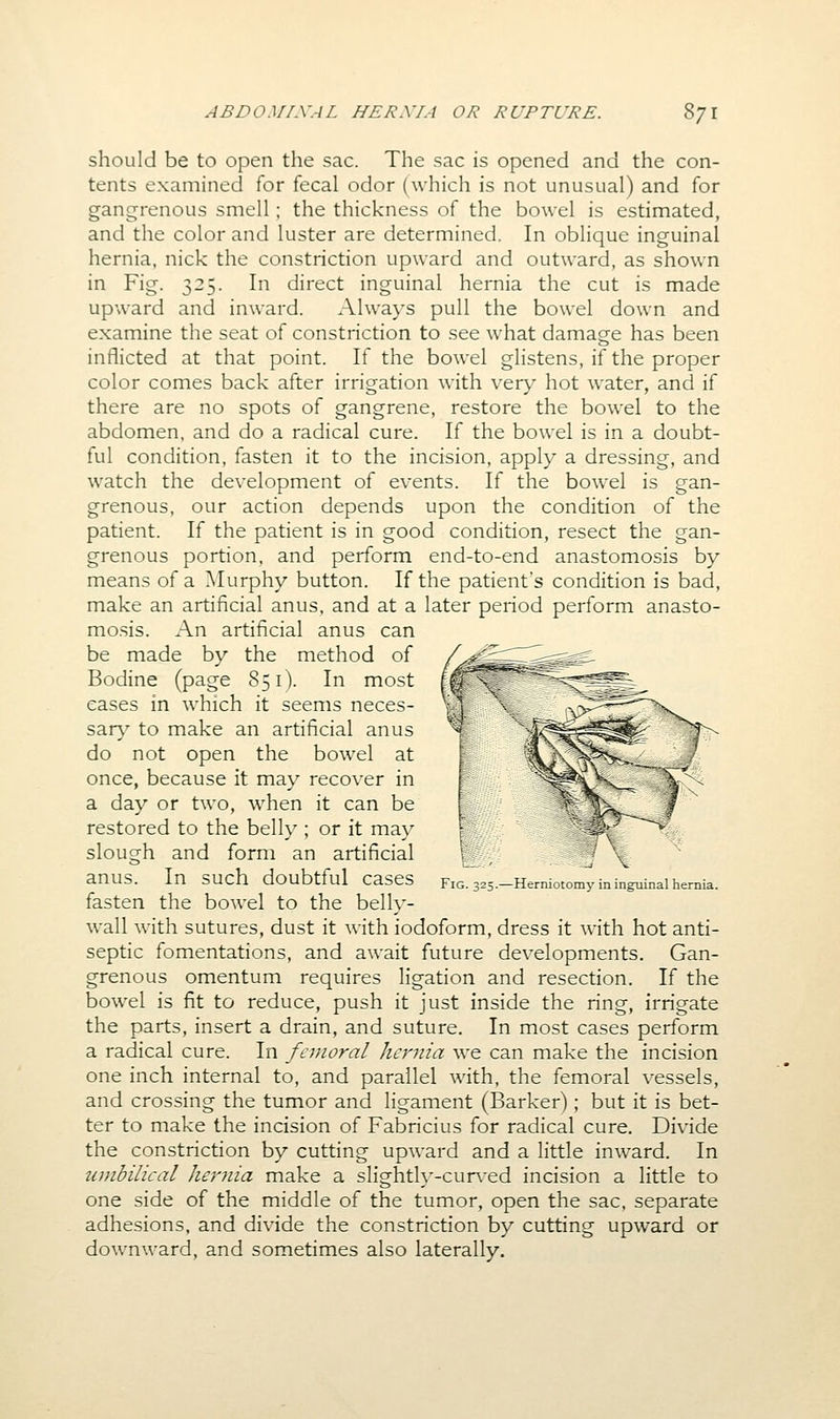 should be to open the sac. The sac is opened and the con- tents examined for fecal odor (which is not unusual) and for gangrenous smell; the thickness of the bowel is estimated, and the color and luster are determined. In oblique inguinal hernia, nick the constriction upward and outward, as shown in Fig. 325. In direct inguinal hernia the cut is made upward and inward. Always pull the bowel down and examine the seat of constriction to see what damage has been inflicted at that point. If the bowel glistens, if the proper color comes back after irrigation with very hot water, and if there are no spots of gangrene, restore the bowel to the abdomen, and do a radical cure. If the bowel is in a doubt- ful condition, fasten it to the incision, apply a dressing, and watch the development of events. If the bowel is gan- grenous, our action depends upon the condition of the patient. If the patient is in good condition, resect the gan- grenous portion, and perform end-to-end anastomosis by means of a Murphy button. If the patient's condition is bad, make an artificial anus, and at a later period perform anasto- mosis. An artificial anus can be made by the method of Bodine (page 851). In most eases in which it seems neces- sary^ to make an artificial anus do not open the bowel at once, because it may recover in a day or two, w^hen it can be restored to the belly ; or it may slough and form an artificial lSi«' •^ (12:.:-:', _ V anus. In such doubtful cases Ficsss—Hemiotomy in inguinal hemia. fasten the bowel to the belh*- wall with sutures, dust it with iodoform, dress it with hot anti- septic fomentations, and await future developments. Gan- grenous omentum requires ligation and resection. If the bowel is fit to reduce, push it just inside the ring, irrigate the parts, insert a drain, and suture. In most cases perform a radical cure. In femoral hernia we can make the incision one inch internal to, and parallel with, the femoral vessels, and crossing the tumor and ligament (Barker); but it is bet- ter to make the incision of Fabricius for radical cure. Divide the constriction by cutting upward and a little inward. In iiuibilical hernia make a slighth'-cun-ed incision a little to one side of the middle of the tumor, open the sac, separate adhesions, and divide the constriction by cutting upward or downward, and sometimes also laterally.