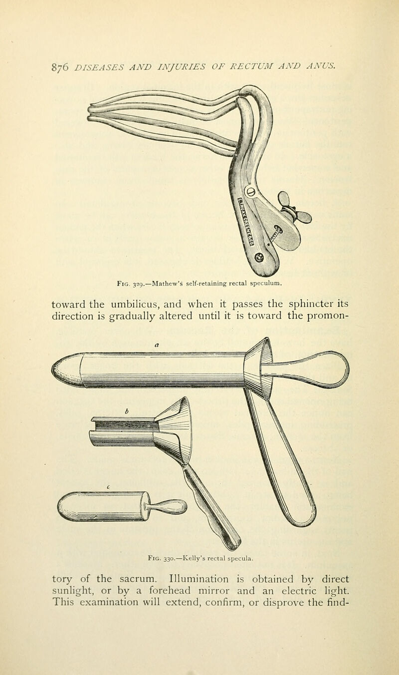 Fig. 329.—Mathew's self-retaining rectal speculum. toward the umbilicus, and when it passes the sphincter its direction is gradually altered until it is toward the promon- FiG. 330.—Kelly's rectal specula. tory of the sacrum. Illumination is obtained by direct sunlight, or by a forehead mirror and an electric light. This examination will extend, confirm, or disprove the find-