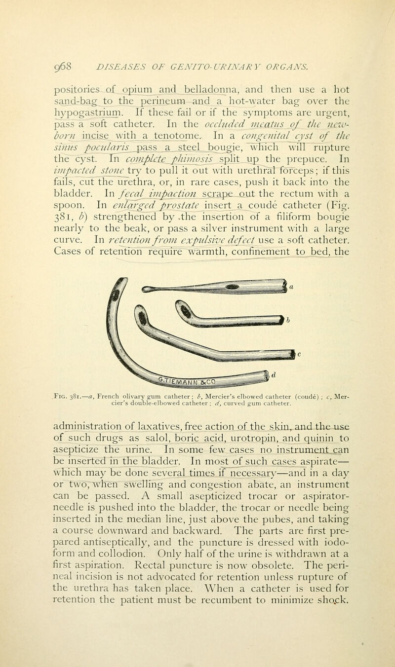 positories of opium_ and^ belladonna, and then use a hot sand-bag to the perineum and a hot-water bag over the hypogastrium. If these fail or if the symptoms are urgent, pass a soft catheter. In the occluded meatus of the nezv- <^6'77/iiicise_ with^aJienotoiTie. In a congenital cyst of the stmts pocularis_ pass a steelbougie. which wilFl-upture the~ cyst. In cgmpl£te_pJwnosj^_^?>^\^^\\^ the prepuce. In impacted stoiie try to pull it out with urethral forceps; if this fails, cut the urethra, or, in rare cases, push it back into the bladder. In fecal impaction sci-ape^Qut the rectum with a spoon. In enlarged prostate insert a coude catheter (Fig. 381, b) strengthened by .the insertion of a filiform bougie nearly to the beak, or pass a silver instrument with a large curve. In retoition from expidsive defect use a soft catheter. Cases of retention require warmth, confinement to bed, the .Fig. 381.—a, French olivary gum catheter; /', Mercier's elbowed catheter (coude); c, Mer- cier's double-elbowed catheter ; d, curved gum catheter. administration of laxatives, free action of the skia^and the use of such drugs as salol, boric acid, urotropin, and quinin to asepticize the urine. In some few cases no instrument_can be inserted in the bladder. In most of such cases aspirate— which may be done several times if necessary—and in a day or two, when swelling and congestion abate, an instrument can be passed. A small asepticized trocar or aspirator- needle is pushed into the bladder, the trocar or needle being inserted in the median line, just above the pubes, and taking a course downward and backward. The parts are first pre- pared antiseptically, and the puncture is dressed with iodo- form and collodion. Only half of the urine is withdrawn at a first aspiration. Rectal puncture is now obsolete. The peri- neal incision is not advocated for retention unless rupture of the urethra has taken place. When a catheter is used for retention the patient must be recumbent to minimize sho.ck.