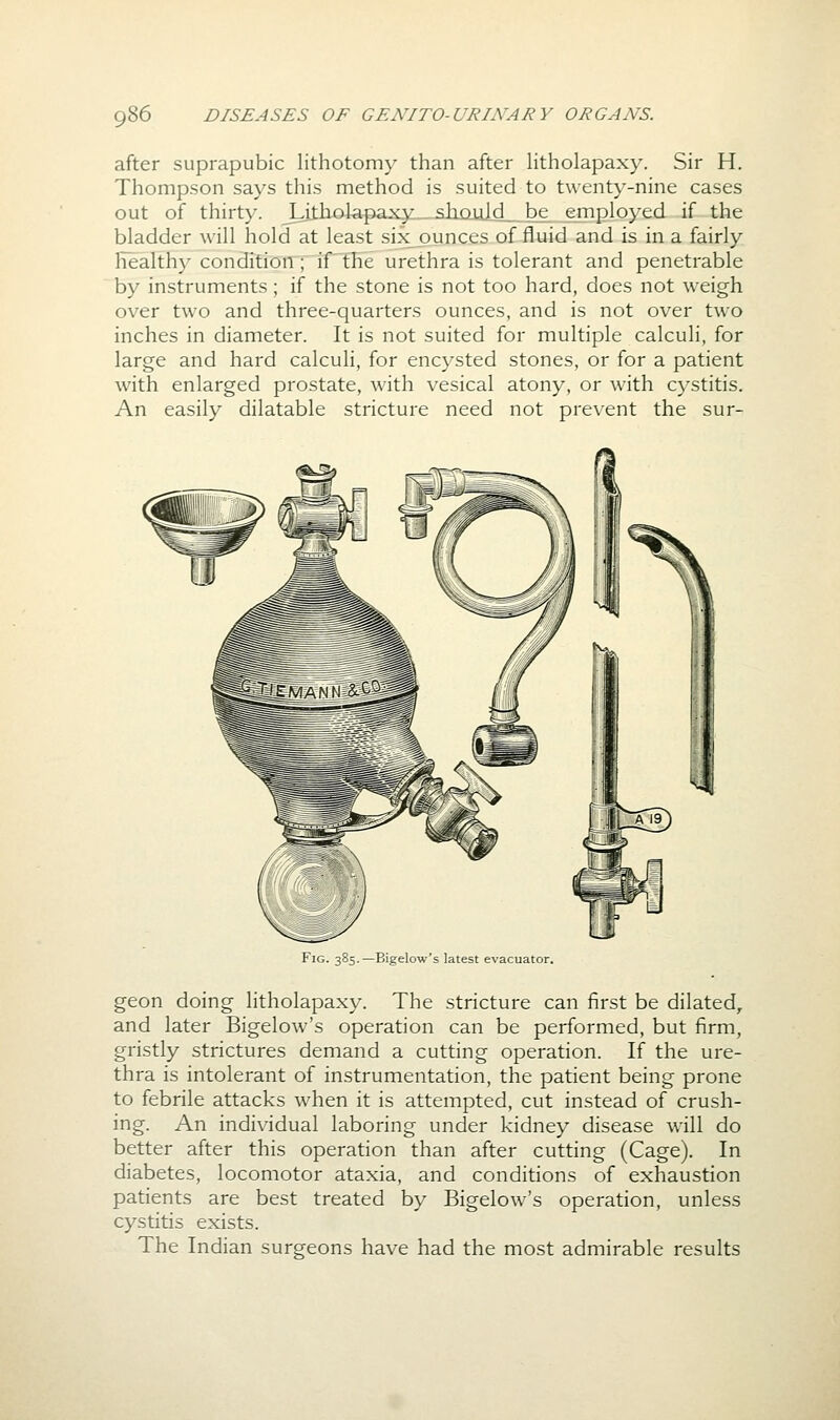 after suprapubic lithotomy than after Htholapaxy. Sir H. Thompson says this method is suited to twenty-nine cases out of thirty. _Litholapaxy:_ slimjLLd_. be employed if the bladder will hold at least six ounces of fluid and is in a fairly ITealthy condition; if the urethra is tolerant and penetrable by instruments; if the stone is not too hard, does not weigh over two and three-quarters ounces, and is not over two inches in diameter. It is not suited for multiple calculi, for large and hard calculi, for encysted stones, or for a patient with enlarged prostate, with vesical atony, or with cystitis. An easily dilatable stricture need not prevent the sur- FiG. 385.—Bigelow's latest evacuator. geon doing Htholapaxy. The stricture can first be dilated^ and later Bigelow's operation can be performed, but firm, gristly strictures demand a cutting operation. If the ure- thra is intolerant of instrumentation, the patient being prone to febrile attacks when it is attempted, cut instead of crush- ing. An individual laboring under kidney disease will do better after this operation than after cutting (Cage). In diabetes, locomotor ataxia, and conditions of exhaustion patients are best treated by Bigelow's operation, unless cystitis exists. The Indian surgeons have had the most admirable results