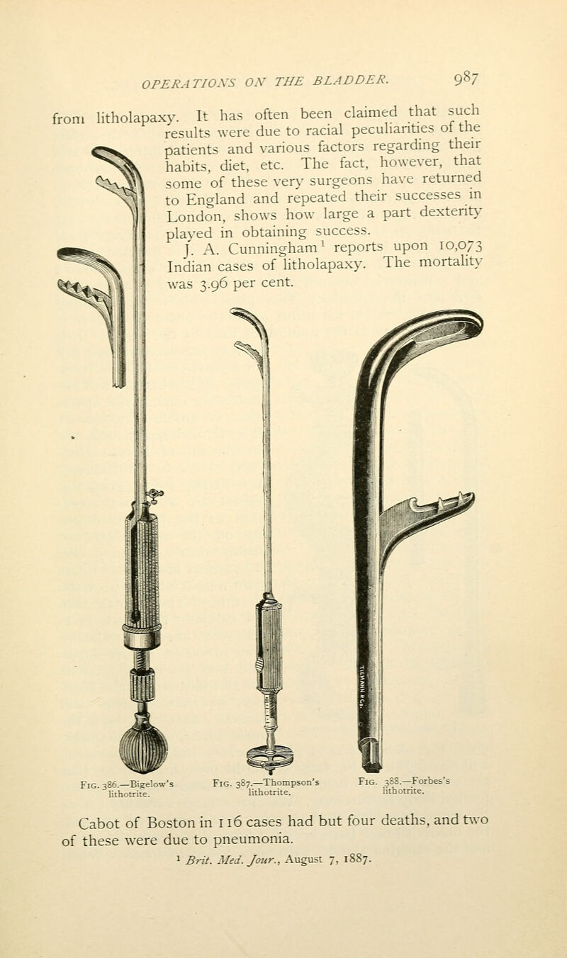 from litholapaxy. It has often been claimed that such results were due to racial peculiarities ot the patients and various factors regarding their habits, diet, etc. The fact, however, that some of these very surgeons have returned to England and repeated their successes in London, shows how large a part dextent}^ played in obtaining success. J. A. Cunningham^ reports upon 10,073 Indian cases of litholapaxy. The mortality was 3.96 per cent. Fig. 386.—Bigelow's lithotrite. Fig. 387.—Thompson's lithotrite. Fig. 38S.—Forbes's lithotrite. Cabot of Boston in 116 cases had but four deaths, and two of these were due to pneumonia. 1 Brit. Med. Jour., August 7, 1887.