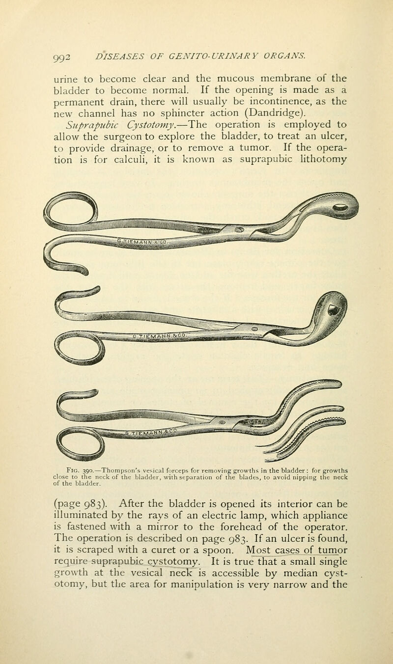 urine to become clear and the mucous membrane of the bladder to become normal. If the opening is made as a permanent drain, there will usually be incontinence, as the new channel has no sphincter action (Dandridge). Suprapubic Cystotomy.—The operation is employed to allow the surgeon to explore the bladder, to treat an ulcer, to provide drainage, or to remove a tumor. If the opera- tion is for calculi, it is known as suprapubic lithotomy Fig. 390.—Thompson's vesical forceps for removing growths in the bladder : for growths close to the neck of the bladder, with separation of the blades, to avoid nipping the neck of the bladder. (page 983). After the bladder is opened its interior can be illuminated by the rays of an electric lamp, which appliance is fastened with a mirror to the forehead of the operator. The operation is described on page 983. If an ulcer is found, it is scraped with a curet or a spoon. Most cases of turnor require suprapubic cystotomy. It is true that a small single growth at the vesical neck is accessible by median cyst- otomy, but the area for manipulation is very narrow and the