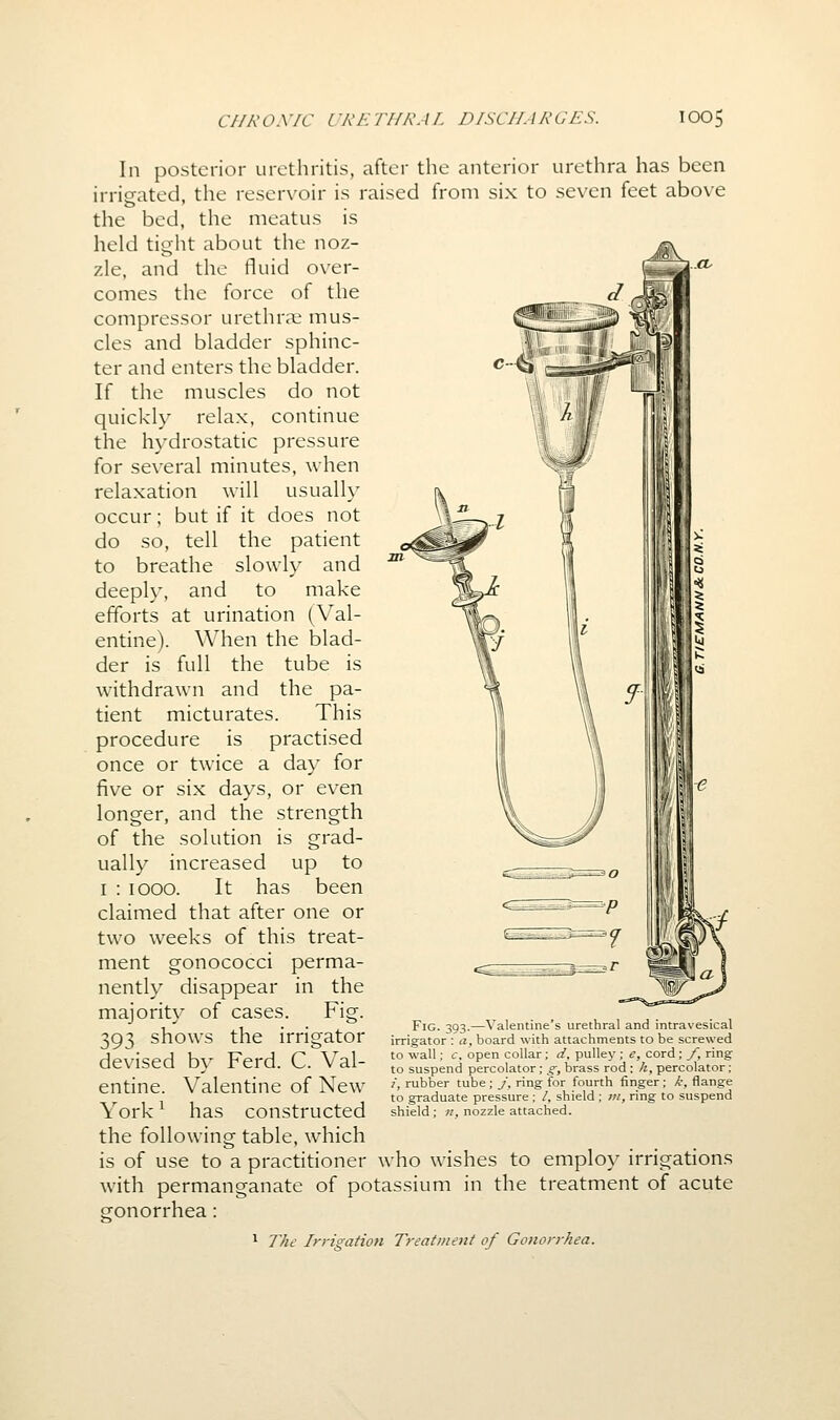 In posterior urethritis, after the anterior urethra has been irrigated, the reservoir is raised from six to seven feet above the bed, the meatus is held tight about the noz- zle, and the fluid over- comes the force of the compressor urethrs mus- cles and bladder sphinc- ter and enters the bladder. If the muscles do not quickly relax, continue the hydrostatic pressure for several minutes, when relaxation will usually occur; but if it does not do so, tell the patient to breathe slowly and deeply, and to make efforts at urination (Val- entine). When the blad- der is full the tube is withdrawn and the pa- tient micturates. This procedure is practised once or twice a day for five or six days, or even longer, and the strength of the solution is grad- ually increased up to I : 1000. It has been claimed that after one or two weeks of this treat- ment gonococci perma- nently disappear in the majority of cases. Fig. 393 shows the irrigator devised by Ferd. C. Val- entine. Valentine of New York ^ has constructed the following table, which is of use to a practitioner who wishes to employ irrigations with permanganate of potassium in the treatment of acute gonorrhea: ^ The Irrigation Treatment of Gonorrhea. Fig. ^93.—Valentine's urethral and intravesical irrigator : a, board with attachments to be screwed to wall: c. open collar; d. pulley ; e, cord ; /, ring to suspend percolator; g, brass rod ; h, percolator; /, rubber tube ; j, ring for fourth finger ; k, flange to graduate pressure : /, shield ; in, ring to suspend shield ; n, nozzle attached.