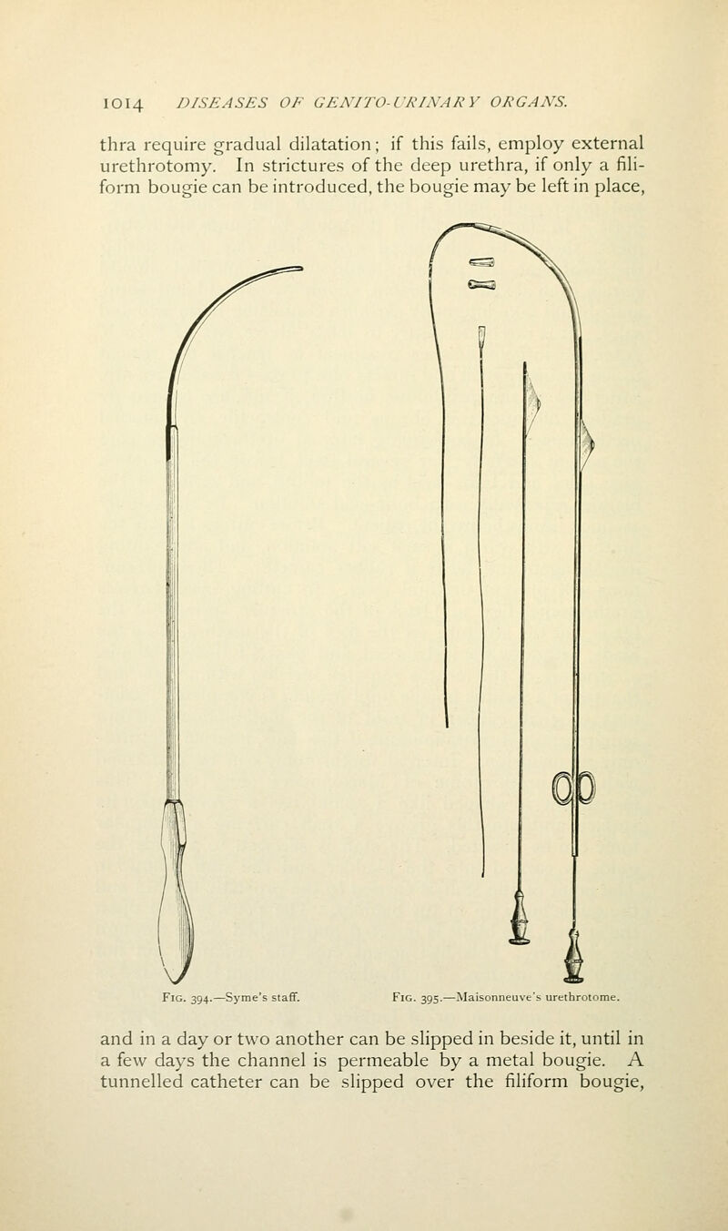 thra require gradual dilatation; if this fails, employ external urethrotomy. In strictures of the deep urethra, if only a fili- form bougie can be introduced, the bougie may be left in place. Fig. 394.—Syme's staff. Fig. 395.—Maisonneuve's urethrotome. and in a day or two another can be slipped in beside it, until in a few days the channel is permeable by a metal bougie. A tunnelled catheter can be slipped over the filiform bougie,