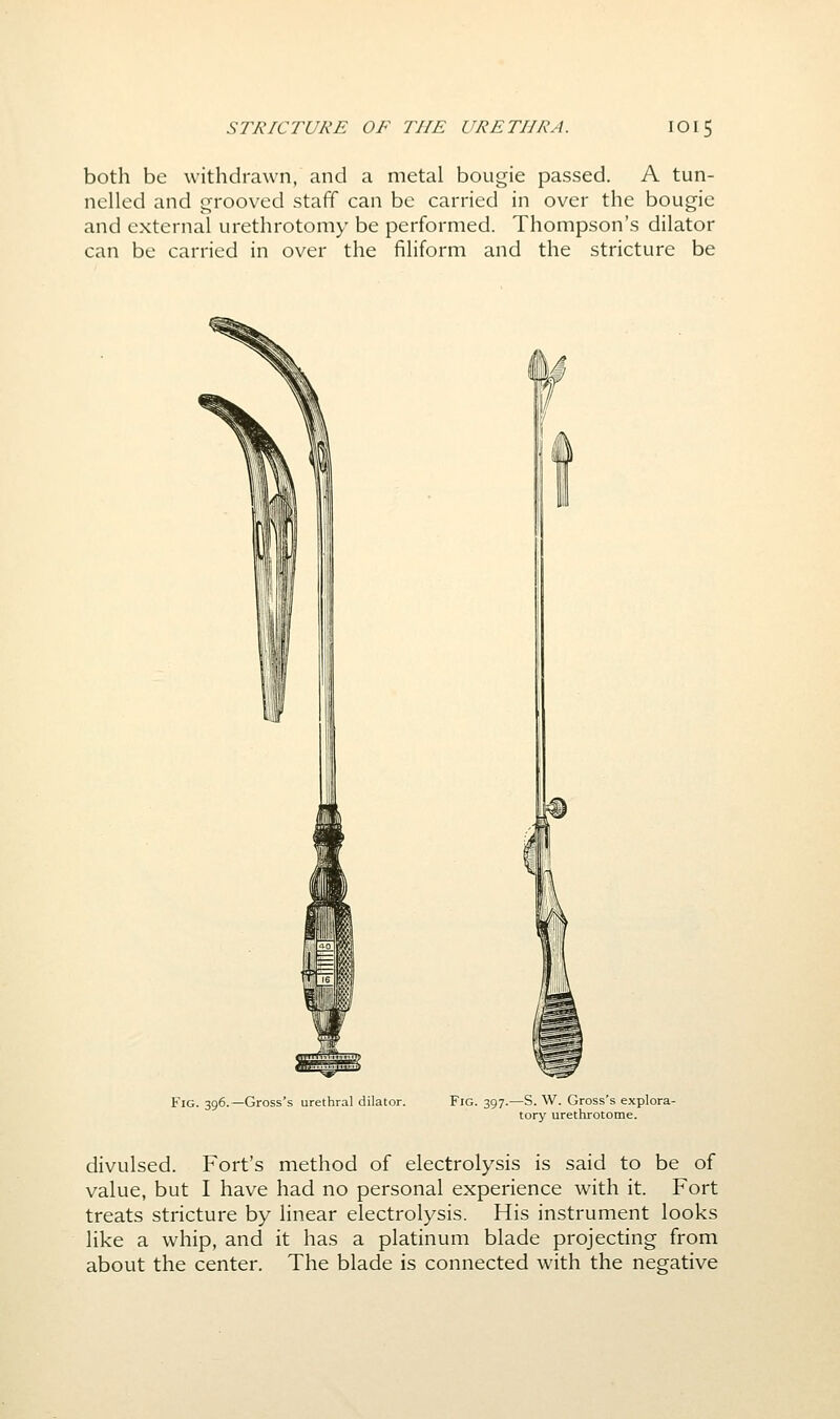 both be withdrawn, and a metal bougie passed. A tun- nelled and grooved staff can be carried in over the bougie and external urethrotomy be performed. Thompson's dilator can be carried in over the filiform and the stricture be Fig. 396.—Gross's urethral dilator. Fig. 397.—S. W. Gross's explora- tory urethrotome. divulsed. Fort's method of electrolysis is said to be of value, but I have had no personal experience with it. Fort treats stricture by linear electrolysis. His instrument looks like a whip, and it has a platinum blade projecting from about the center. The blade is connected with the negative