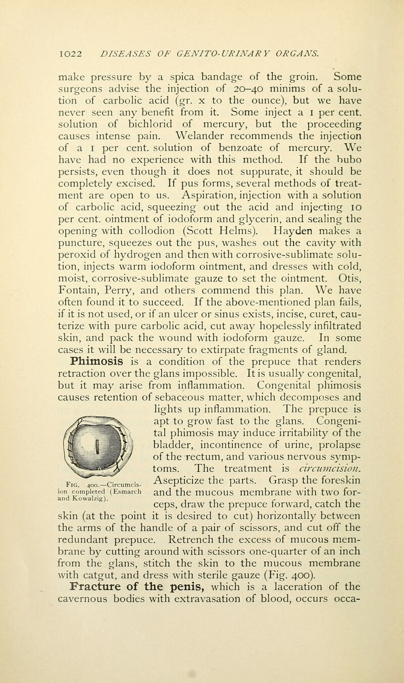 make pressure by a spica bandage of the groin. Some surgeons advise the injection of 20—40 minims of a solu- tion of carboHc acid (gr. x to the ounce), but we have never seen any benefit from it. Some inject a i per cent, solution of bichlorid of mercury, but the proceeding causes intense pain. Welander recommends the injection of a I per cent, solution of benzoate of mercury. We have had no experience with this method. If the bubo persists, even though it does not suppurate, it should be completely excised. If pus forms, several methods of treat- ment are open to us. Aspiration, injection with a solution of carbolic acid, squeezing out the acid and injecting 10 per cent, ointment of iodoform and glycerin, and sealing the opening with collodion (Scott Helms). Hayden makes a puncture, squeezes out the pus, washes out the cavity with peroxid of hydrogen and then with corrosive-sublimate solu- tion, injects warm iodoform ointment, and dresses with cold, moist, corrosive-sublimate gauze to set the ointment. Otis, Fontain, Perry, and others commend this plan. We have often found it to succeed. If the above-mentioned plan fails, if it is not used, or if an ulcer or sinus exists, incise, curet, cau- terize with pure carbolic acid, cut away hopelessly infiltrated skin, and pack the wound with iodoform gauze. In some cases it will be necessary to extirpate fragments of gland. Phimosis is a condition of the prepuce that renders retraction over the glans impossible. It is usually congenital, but it may arise from inflammation. Congenital phimosis causes retention of sebaceous matter, which decomposes and lights up inflammation. The prepuce is ^^g^^^V apt to grow fast to the glans. Congeni- fj^^^^^^^'X tal phimosis may induce irritability of the |r - i a^BtI bladder, incontinence of urine, prolapse \^^^^^^^^ff of the rectum, and various nervous symp- ^^^^^^W^ toms. The treatment is circumcision. FiG.4oo-Circumcis- Ascpticizc the parts. Grasp the foreskin ion completed (Esmarch and the mucous membrane with two for- and Kowalzig). , . ^ i ^ i ji ceps, draw the prepuce lorward, catch the skin (at the point it is desired to cut) horizontally between the arms of the handle of a pair of scissors, and cut off the redundant prepuce. Retrench the excess of mucous mem- brane by cutting around with scissors one-quarter of an inch from the glans, stitch the skin to the mucous membrane with catgut, and dress with sterile gauze (Fig. 400). Fracture of the penis, which is a laceration of the cavernous bodies with extravasation of blood, occurs occa-