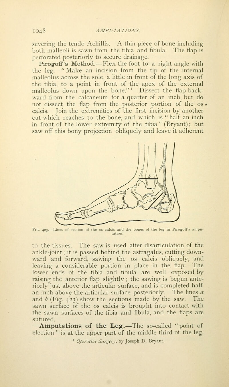 sev'cring the tendo Achillis. A thin piece of bone including both malleoH is sawn from the tibia and fibula. The flap is perforated posteriorly to secure drainage. Pirogoff's Method.—Flex the foot to a right angle with the leg.  Make an incision from the tip of the internal malleolus across the sole, a little in front of the long axis of the tibia, to a point in front of the apex of the external malleolus down upon the bone. ^ Dissect the flap back- ward from the calcaneum for a quarter of an inch, but do not dissect the flap from the posterior portion of the os calcis. Join the extremities of the first incision by another cut w^hich reaches to the bone, and which is  half an inch in front of the lower extremity of the tibia  (Br\'ant); but saw off this bony projection obliquely and leave it adherent Fig. 423.—Lines of section of the os calcis and the bones of the leg in PirogofTs ampu- tation. to the tissues. The saw is used after disarticulation of the ankle-joint; it is passed behind the astragalus, cutting down- ward and forward, sawing the os calcis obliquely, and leaving a considerable portion in place in the flap. The lower ends of the tibia and fibula are well exposed by raising the anterior flap slightly; the sawing is begun ante- riorly just above the articular surface, and is completed half an inch above the articular surface posteriorly. The lines a and b (Fig. 423) show the sections made by the saw. The sawn surface of the os calcis is brought into contact with the sawn surfaces of the tibia and fibula, and the flaps are sutured. Amputations of the I^eg.—The so-called  point of election  is at the upper part of the middle third of the leg. ^ Operative Surgery, by Joseph D. Bryant.