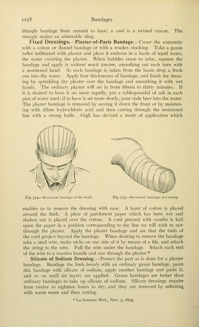 triangle bandage from summit to base; a cord is a twisted cravat. The triangle makes an admirable sling. Fixed Dressings.—Plaster-of-Paris Bandage.—Cover the extremity with a cotton or flannel bandage or with a woolen stocking. Take a gauze roller infiltrated with plaster and place it endwise in a basin of tepid water, the water covering the plaster. When bubbles cease to arise, squeeze the bandage and apply it without much tension, smoothing out each turn with a moistened hand. As each bandage is taken from the basin drop a fresh one into the water. Apply four thicknesses of bandage, and finish the dress- ing by sprinkling dry plaster over the bandage and smoothing it with wet hands. The ordinary plaster will set in from fifteen to thirty minutes. If it is desired to have it set more rapidly, put a tablespoonful of salt in each pint of water used; if to have it set more slowly, pour stale beer into the water. The plaster bandage is removed by sawing it down the front or by moisten- ing with dilute hydrochloric acid and then cutting through the moistened line with a strong knife. Gigli has devised a mode of application which Fig. 754.—Recurrent bandage of the head. Fig. 755.—Recurrent bandage of a stump. enables us to remove the dressing with ease. A layer of cotton is placed around the limb. A piece of parchment paper which has been wet and shaken out is placed over the cotton. A cord greased with vaselin is laid upon the paper in a position corresponding to the line we will wish to saw through the plaster. Apply the plaster bandage and see that the ends of the cord project beyond the bandage. When desiring to remove the bandage take a steel wire, make nicks on one side of it by means of a file, and attach the string to the wire. Pull the wire under the bandage. Attach each end of the wire to a wooden handle and saw through the plaster.* Silicate of Sodium Dressing.—Protect the part as is done for a plaster bandage. Bandage the limb loosely with an ordinary gauze bandage, paint this bandage with silicate of sodium, apply another bandage and paint it, and so on until six layers are applied. Gauze bandages are better than ordinary bandages to take up silicate of sodium. SiHcate dressings require from twelve to eighteen hours to dry, and they are removed by softening with warm water and then cutting. * La Semaine Med., Nov. 3, 1895.