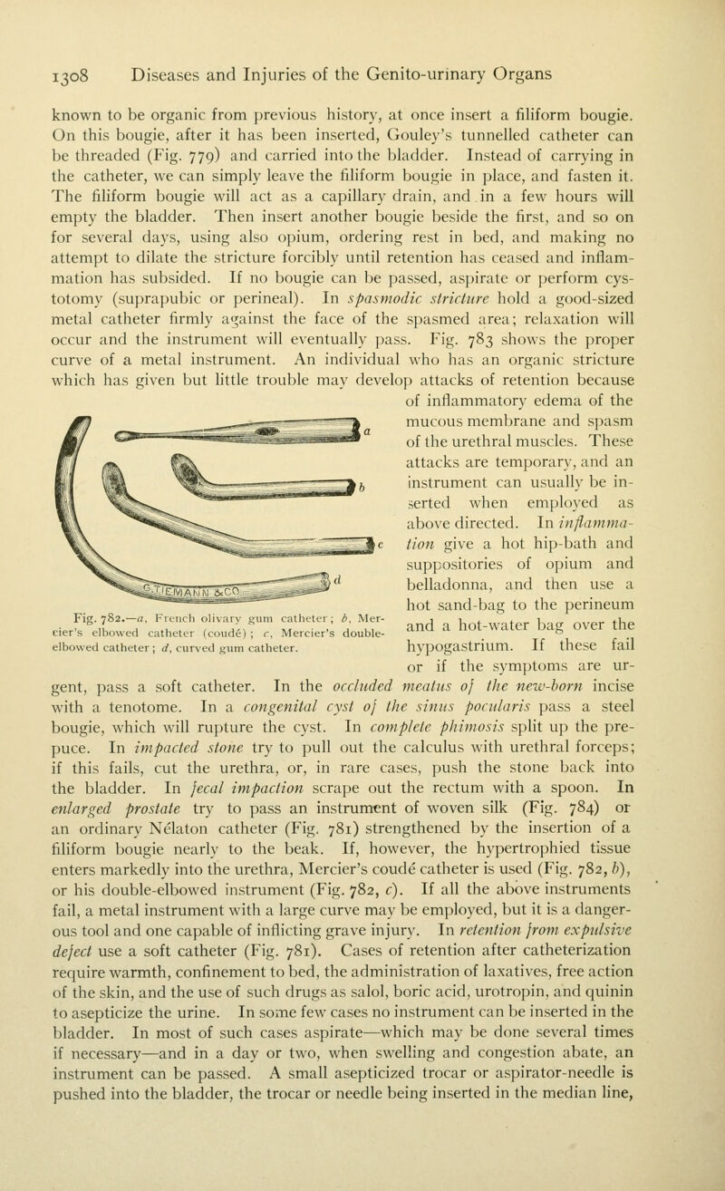 known to be organic from previous history, at once insert a fihform bougie. On this bougie, after it has been inserted, Gouley's tunnelled catheter can be threaded (Fig. 779) and carried into the bladder. Instead of carrying in the catheter, we can simply leave the filiform bougie in place, and fasten it. The filiform bougie will act as a capillary drain, and in a few hours will empty the bladder. Then insert another bougie beside the first, and so on for several days, using also opium, ordering rest in bed, and making no attempt to dilate the stricture forcibly until retention has ceased and inflam- mation has subsided. If no bougie can be passed, aspirate or perform cys- totomy (suprapubic or perineal). In spasmodic stricture hold a good-sized metal catheter firmly against the face of the spasmed area; relaxation will occur and the instrument will eventually pass. Fig. 783 shows the proper curve of a metal instrument. An individual who has an organic stricture which has given but little trouble may develop attacks of retention because of inflammatory edema of the mucous membrane and spasm of the urethral muscles. These attacks are temporary, and an instrument can usually be in- serted when employed as above directed. In inflamma- tion give a hot hip-bath and suppositories of opium and belladonna, and then use a hot sand-bag to the perineum and a hot-water bag over the hypogastrium. If these fail or if the symptoms are ur- gent, pass a soft catheter. In the occluded meatus of the new-born incise with a tenotome. In a congenital cyst oj the sinus pocularis pass a steel bougie, which will rupture the cyst. In complete phimosis split up the pre- puce. In impacted stone try to pull out the calculus with urethral forceps; if this fails, cut the urethra, or, in rare cases, push the stone back into the bladder. In jecal impaction scrape out the rectum with a spoon. In enlarged prostate try to pass an instrument of woven silk (Fig. 784) or an ordinary Nelaton catheter (Fig. 781) strengthened by the insertion of a filiform bougie nearly to the beak. If, however, the hypertrophied tissue enters markedly into the urethra, Mercier's coude catheter is used (Fig. 782, h), or his double-elbowed instrument (Fig. 782, c). If all the above instruments fail, a metal instrument with a large curve may be employed, but it is a danger- ous tool and one capable of inflicting grave injury. In retention jrom expulsive deject use a soft catheter (Fig. 781). Cases of retention after catheterization require warmth, confinement to bed, the administration of laxatives, free action of the skin, and the use of such drugs as salol, boric acid, urotropin, and quinin to asepticize the urine. In some few cases no instrument can be inserted in the bladder. In most of such cases aspirate—which may be done .several times if necessary—and in a day or two, when swelling and congestion abate, an instrument can be passed. A small asepticized trocar or aspirator-needle is pushed into the bladder, the trocar or needle being inserted in the median line, Fig. 782.'—a, French olivary gum catheter ; b, Mer- cier's elbowed catheter (coude) ; r, Mercier's double- elbowed catheter ; d, curved gum catheter.