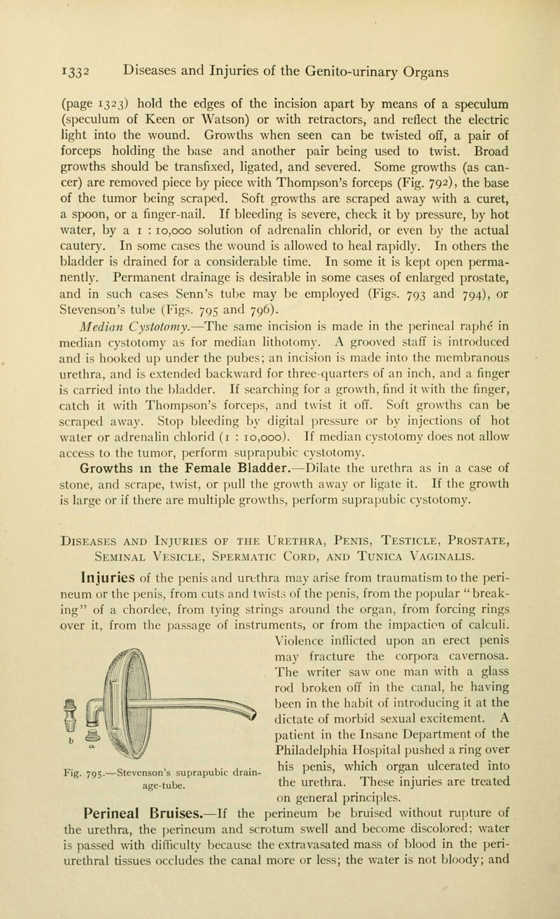(page 1323) hold the edges of the incision apart by means of a speculum (speculum of Keen or Watson) or with retractors, and reflect the electric light into the wound. Growths when seen can be twisted off, a pair of forceps holding the base and another pair being used to twist. Broad growths should be transfixed, ligated, and severed. Some growths (as can- cer) are removed piece by piece with Thompson's forceps (Fig. 792), the base of the tumor being scraped. Soft growths are scraped away with a curet, a spoon, or a finger-nail. If bleeding is severe, check it by pressure, by hot water, by a i : 10,000 solution of adrenalin chlorid, or even by the actual cautery. In some cases the wound is allowed to heal rapidly. In others the bladder is drained for a considerable time. In some it is kept open perma- nently. Permanent drainage is desirable in some cases of enlarged prostate, and in such cases Senn's tube may be employed (Figs. 793 and 794), or Stevenson's tube (Figs. 795 and 796). Median Cystotomy.—The same incision is made in the perineal raphe in median cystotomy as for median lithotomy. A grooved staff is introduced and is hooked up under the pubes; an incision is made into the membranous urethra, and is extended backward for three-quarters of an inch, and a finger is carried into the bladder. If searching for a growth, find it with the finger, catch it with Thompson's forceps, and twist it off. Soft growths can be scraped away. Stop bleeding by digital pressure or by injections of hot water or adrenahn chlorid (i : 10,000). If median cystotomy does not allow access to the tumor, perform suprapubic cystotomy. Growths in the Female Bladder.—Dilate the urethra as in a case of stone, and scrape, twist, or pull the growth away or ligate it. If the growth is large or if there are multiple growths, perform suprapubic cystotomy. Diseases and Injuries of the Urethra, Penis, Testicle, Prostate, Seminal Vesicle, Spermatic Cord, and Tunica Vaginalis. Injuries of the penis and urtthra may arise from traumatism to the peri- neum or the penis, from cuts and twists of the penis, from the popular  break- ing of a chordee, from tying strings around the organ, from forcing rings over it, from the passage of instruments, or from the impaction of calculi. Violence inflicted upon an erect penis may fracture the corpora cavernosa. The writer saw one man with a glass rod broken off in the canal, he having been in the habit of introducing it at the dictate of morbid sexual excitement. A patient in the Insane Department of the Philadelphia Hospital pushed a ring over his penis, which organ ulcerated into the urethra. These injuries are treated on general principles. Perinea! Bruises.—If the perineum be bruised without rupture of the urethra, the perineum and scrotum swell and become discolored; water is passed with difficulty because the extravasated mass of blood in the peri- urethral tissues occludes the canal more or less; the water is not bloody; and Fig. 795.—Stevenson's suprapubic drain- age-tube.
