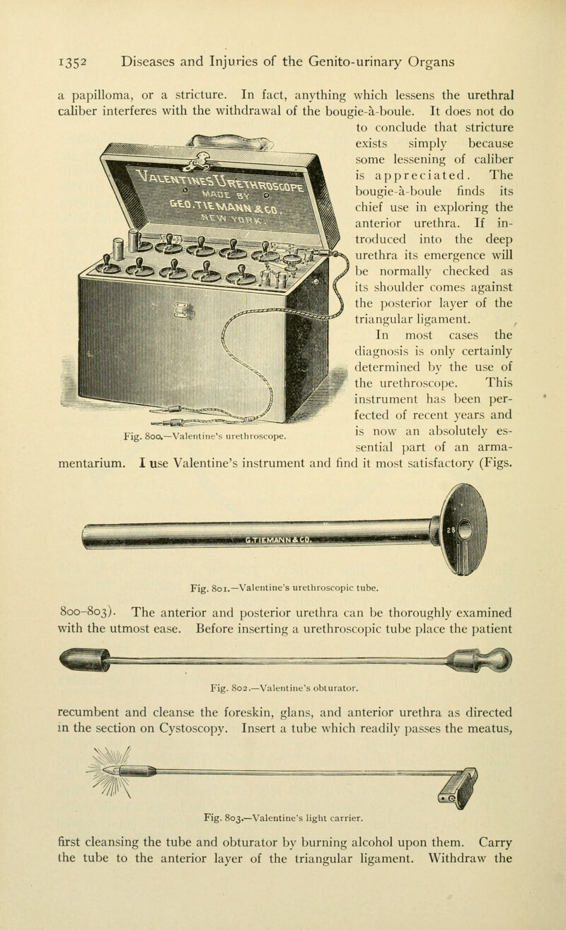 a papilloma, or a stricture. In fact, anything which lessens the urethral caliber interferes with the withdrawal of the bougie-a-boule. It does not do to conclude that stricture exists simply because some lessening of caliber is appreciated. The bougie-a-boule iinds its chief use in exploring the anterior urethra. If in- troduced into the deep urethra its emergence will he normally checked as its shoulder comes against the posterior layer of the triangular hgament. , In most cases the diagnosis is only certainly determined by the use of the urethroscope. This instrument has been per- fected of recent years and is now an absolutely es- sential part of an arma- I use Valentine's instrument and find it most satisfactory (Figs. Fig. 800,—Valentine's urethroscope. mentarium. Fig. 801.—Valentine's urethroscopic tube. 800-803). The anterior and posterior urethra can be thoroughly examined with the utmost ease. Before inserting a urethroscopic tube place the patient Fig. 802.—Valentine's obturator. recumbent and cleanse the foreskin, glans, and anterior urethra as directed in the section on Cystoscopy. Insert a tube which readily passes the meatus, Fig. 803,—Valentine's light carrier. first cleansing the tube and obturator by burning alcohol upon them. Carry the tube to the anterior layer of the triangular ligament. Withdraw the