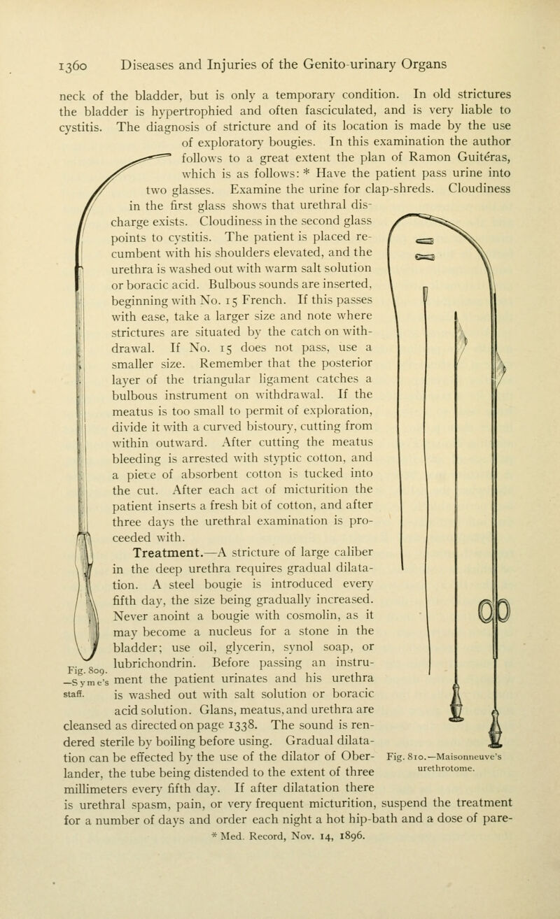 \ neck of the bladder, but is only a temporary condition. In old strictures the bladder is hypertrophied and often fasciculated, and is very liable to cystitis. The diagnosis of stricture and of its location is made by the use of exploratory bougies. In this examination the author follows to a great extent the plan of Ramon Guiteras, which is as follows: * Have the patient pass urine into two glasses. Examine the urine for clap-shreds. Cloudiness in the first glass shows that urethral dis- charge exists. Cloudiness in the second glass points to cystitis. The patient is placed re- cumbent with his shoulders elevated, and the urethra is washed out with warm salt solution or boracic acid. Bulbous sounds are inserted, beginning with No. 15 French. If this passes with ease, take a larger size and note where strictures are situated by the catch on with- drawal. If No. 15 does not pass, use a smaller size. Remember that the posterior layer of the triangular ligament catches a bulbous instrument on withdrawal. If the meatus is too small to permit of exploration, divide it with a curved bistoury, cutting from within outward. After cutting the meatus bleeding is arrested with styptic cotton, and a piece of absorbent cotton is tucked into the cut. After each act of micturition the patient inserts a fresh bit of cotton, and after three days the urethral examination is pro- ceeded with. Treatment.—A stricture of large caliber in the deep urethra requires gradual dilata- tion. A steel bougie is introduced every fifth day, the size being gradually increased. Never anoint a bougie with cosmolin, as it may become a nucleus for a stone in the bladder; use oil, glycerin, synol soap, or ^. „ lubrichondrin. Before passing an instru- Fig. 809. . ^ 11- 1 —Syme's mcnt the patient urmates and his urethra staff. is washed out with salt solution or boracic acid solution. Glans, meatus, and urethra are cleansed as directed on page 1338. The sound is ren- dered sterile by boiling before using. Gradual dilata- tion can be effected by the use of the dilator of Ober- lander, the tube being distended to the extent of three millimeters every fifth day. If after dilatation there is urethral spasm, pain, or very frequent micturition, suspend the treatment for a number of days and order each night a hot hip-bath and a dose of pare- * Med. Record, Nov. 14, 1896. Fig. 810.—Maisonneuve's urethrotome.