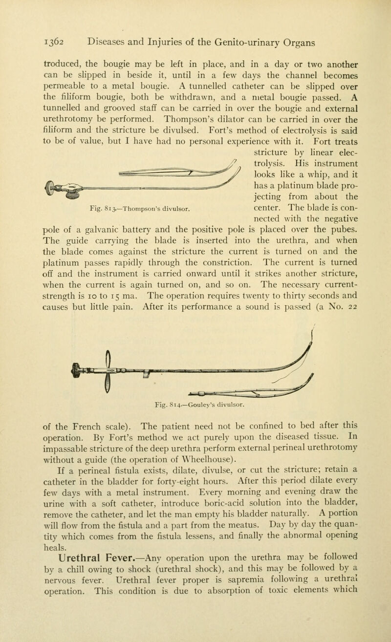 troduced, the bougie may be left in place, and in a day or two another can be slipped in beside it, until in a few days the channel becomes permeable to a metal bougie. A tunnelled catheter can be shpped over the fihform bougie, both be withdrawn, and a metal bougie passed. A tunnelled and grooved staff can be carried in over the bougie and external urethrotomy be performed. Thompson's dilator can be carried in over the fihform and the stricture be divulsed. Fort's method of electrolysis is said to be of value, but I have had no personal experience with it. Fort treats stricture by linear elec- trolysis. His instrument looks like a whip, and it has a platinum blade pro- jecting from about the center. The blade is con- nected with the negative pole of a galvanic battery and the positive pole is placed over the pubes. The guide carrying the blade is inserted into the urethra, and when the blade comes against the stricture the current is turned on and the platinum passes rapidly through the constriction. The current is turned off and the instrument is carried onward until it strikes another stricture, when the current is again turned on, and so on. The necessar}^ current- strength is 10 to 15 ma. The operation requires twenty to thirty seconds and causes but little pain. After its performance a sound is passed (a No. 22 Fig. 813.—Thompson's divulsor. Fig. 814.—Gouley's divulsor. of the French scale). The patient need not be confined to bed after this operation. By Fort's method we act purely upon the diseased tissue. In impassable stricture of the deep urethra perform external perineal urethrotomy without a guide (the operation of Wheelhouse). If a perineal fistula exists, dilate, divulse, or cut the stricture; retain a catheter in the bladder for forty-eight hours. After this period dilate every few days with a metal instrument. Every morning and evening draw the urine with a soft catheter, introduce boric-acid solution into the bladder, remove the catheter, and let the man empty his bladder naturally. A portion will flow from the fistula and a part from the meatus. Day by day the quan- tity which comes from the fistula lessens, and finally the abnormal opening heals. Urethral Fever.—Any operation upon the urethra may be followed by a chill owing to shock (urethral shock), and this may be followed by a nervous fever. Urethral fever proper is sapremia following a urethral operation. This condition is due to absorption of toxic elements which