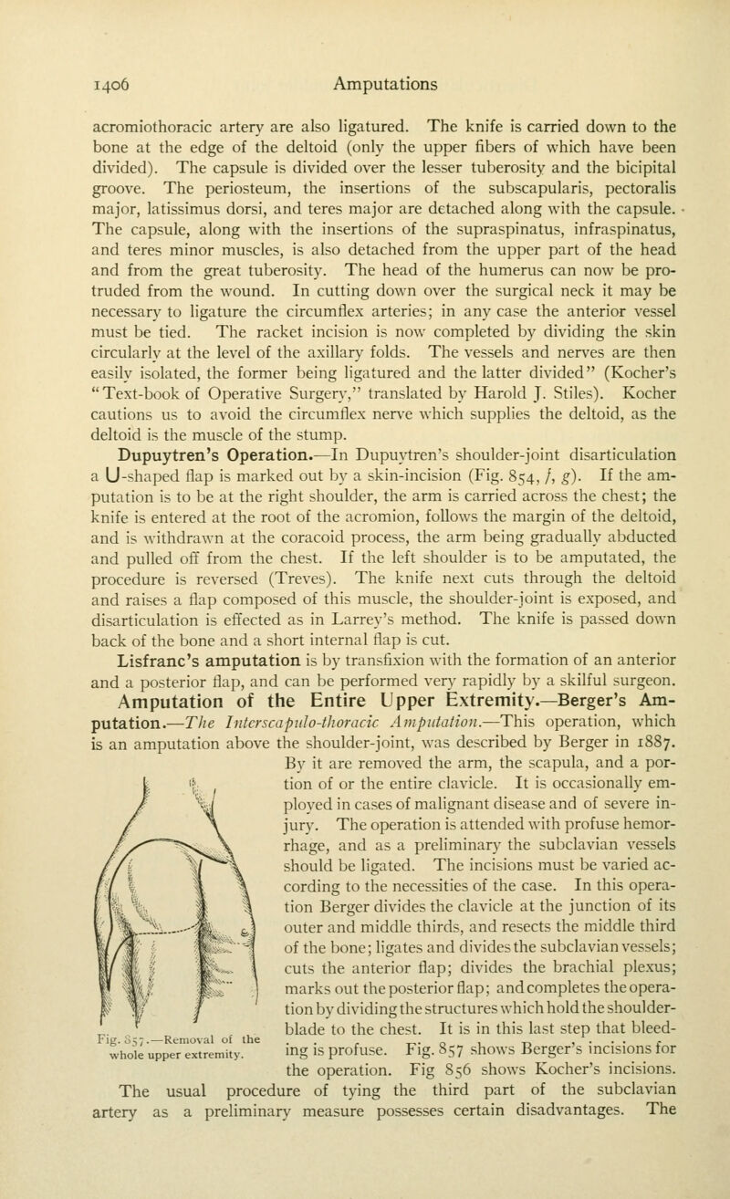 acromiothoracic artery are also ligatured. The knife is carried down to the bone at the edge of the deltoid (only the upper fibers of which have been divided). The capsule is divided over the lesser tuberosity and the bicipital groove. The periosteum, the insertions of the subscapularis, pectoralis major, latissimus dorsi, and teres major are detached along with the capsule. The capsule, along with the insertions of the supraspinatus, infraspinatus, and teres minor muscles, is also detached from the upper part of the head and from the great tuberosity. The head of the humerus can now be pro- truded from the wound. In cutting down over the surgical neck it may be necessary to ligature the circumflex arteries; in any case the anterior vessel must be tied. The racket incision is now completed by dividing the skin circularly at the level of the axillary folds. The vessels and nerves are then easily isolated, the former being ligatured and the latter divided (Kocher's Text-book of Operative Surgery, translated by Harold J- Stiles). Kocher cautions us to avoid the circumflex nerve which supplies the deltoid, as the deltoid is the muscle of the stump. Dupuytren's Operation.—In Dupuytren's shoulder-joint disarticulation a U-shaped flap is marked out by a skin-incision (Fig. 854, /, g). If the am- putation is to be at the right shoulder, the arm is carried across the chest; the knife is entered at the root of the acromion, follows the margin of the deltoid, and is withdrawn at the coracoid process, the arm being gradually abducted and pulled off from the chest. If the left shoulder is to be amputated, the procedure is reversed (Treves). The knife next cuts through the deltoid and raises a flap composed of this muscle, the shoulder-joint is exposed, and disarticulation is effected as in Larrey's method. The knife is passed down back of the bone and a short internal flap is cut. Lisfranc's amputation is by transfixion with the formation of an anterior and a posterior flap, and can be performed very rapidly by a skilful surgeon. Amputation of the Entire Upper Extremity.—Berger's Am- putation.—The Intcrscapido-thoracic Amputation.—This operation, which is an amputation above the shoulder-joint, was described by Berger in 1887. By it are removed the arm, the scapula, and a por- tion of or the entire clavicle. It is occasionally em- ploved in cases of malignant disease and of severe in- jury. The operation is attended with profuse hemor- rhage, and as a preliminary the subclavian vessels should be ligated. The incisions must be varied ac- cording to the necessities of the case. In this opera- tion Berger divides the clavicle at the junction of its outer and middle thirds, and resects the middle third of the bone; hgates and divides the subclavian vessels; cuts the anterior flap; divides the brachial ple.xus; marks out the posterior flap; and completes the opera- tion by dividing the structures which hold the shoulder- blade to the chest. It is in this last step that bleed- ing is profuse. Fig. 857 .shows Berger's incisions for the operation. Fig 856 shows Kocher's incisions. The usual procedure of tying the third part of the subclavian artery as a preliminary measure possesses certain disadvantages. The Fig. 857.—Removal of the whole upper extremity.