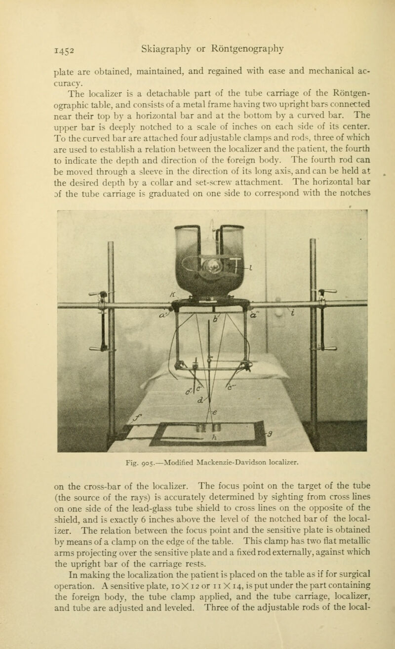 plate are obtained, maintained, and regained with ease and mechanical ac- curacy. The localizer is a detachable part of the tube carriage of the Rontgen- ographic table, and consists of a metal frame having two upright bars connected near their top by a horizontal bar and at the bottom by a cur\ed bar. The upper bar is deeply notched to a scale of inches on each side of its center. To the cuned bar are attached four adjustable clamps and rods, three of which are used to estabUsh a relation between the localizer and the patient, the fourth to indicate the depth and direction of the foreign body. The fourth rod can be moved through a sleeve in the direction of its long axis, and can be held at the desired depth by a collar and set-screw attachment. The horizontal bar Df the tube carriage is graduated on one side to correspond with the notches Fig. 905.—Modified Mackenzie-Davidson localizer. on the cross-bar of the localizer. The focus point on the target of the tube (the source of the rays) is accurately determined by sighting from cross Unes on one side of the lead-glass tube shield to cross Unes on the opposite of the shield, and is exactly 6 inches above the level of the notched bar of the local- izer. The relation between the focus point and the sensitive plate is obtained by means of a clamp on the edge of the table. This clamp has two flat metallic arms projecting over the sensitive plate and a fixed rod externally, against which the upright bar of the carriage rests. In making the locaHzation the patient is placed on the table as if for surgical operation. A sensitive plate, loX 12 or 11 X 14, is put under the part containing the foreign body, the tube clamp appUed, and the tube carriage, localizer, and tube are adjusted and leveled. Three of the adjustable rods of the local-