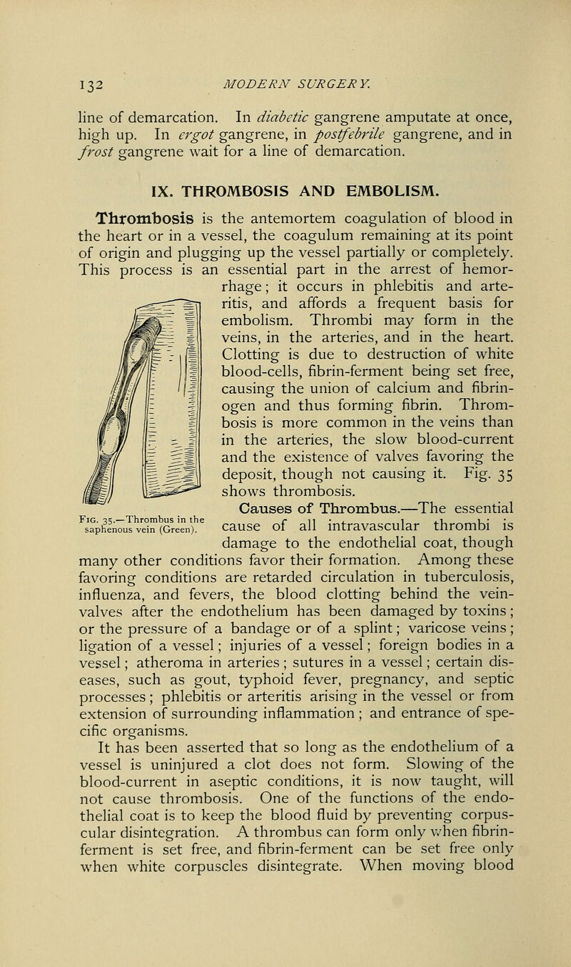 line of demarcation. In diabetic gangrene amputate at once, high up. In ergot gangrene, in postfebrile gangrene, and in frost gangrene wait for a line of demarcation. IX. THROMBOSIS AND EMBOLISM. Thrombosis is the antemortem coagulation of blood in the heart or in a vessel, the coagulum remaining at its point of origin and plugging up the vessel partially or completely. This process is an essential part in the arrest of hemor- rhage ; it occurs in phlebitis and arte- ritis, and affords a frequent basis for embolism. Thrombi may form in the veins, in the arteries, and in the heart. Clotting is due to destruction of white blood-cells, fibrin-ferment being set free, causing the union of calcium and fibrin- ogen and thus forming fibrin. Throm- bosis is more common in the veins than in the arteries, the slow blood-current and the existence of valves favoring the deposit, though not causing it. Fig. 35 shows thrombosis. Causes of Thrombus.—The essential cause of all intravascular thrombi is damage to the endothelial coat, though many other conditions favor their formation. Among these favoring conditions are retarded circulation in tuberculosis, influenza, and fevers, the blood clotting behind the vein- valves after the endothelium has been damaged by toxins ; or the pressure of a bandage or of a splint; varicose veins; ligation of a vessel; injuries of a vessel; foreign bodies in a vessel; atheroma in arteries ; sutures in a vessel; certain dis- eases, such as gout, typhoid fever, pregnancy, and septic processes; phlebitis or arteritis arising in the vessel or from extension of surrounding inflammation ; and entrance of spe- cific organisms. It has been asserted that so long as the endothelium of a vessel is uninjured a clot does not form. Slowing of the blood-current in aseptic conditions, it is now taught, will not cause thrombosis. One of the functions of the endo- thelial coat is to keep the blood fluid by preventing corpus- cular disintegration. A thrombus can form only v/hen fibrin- ferment is set free, and fibrin-ferment can be set free only when white corpuscles disintegrate. When moving blood Fig. 35.—Thrombus in the saphenous vein (Green).