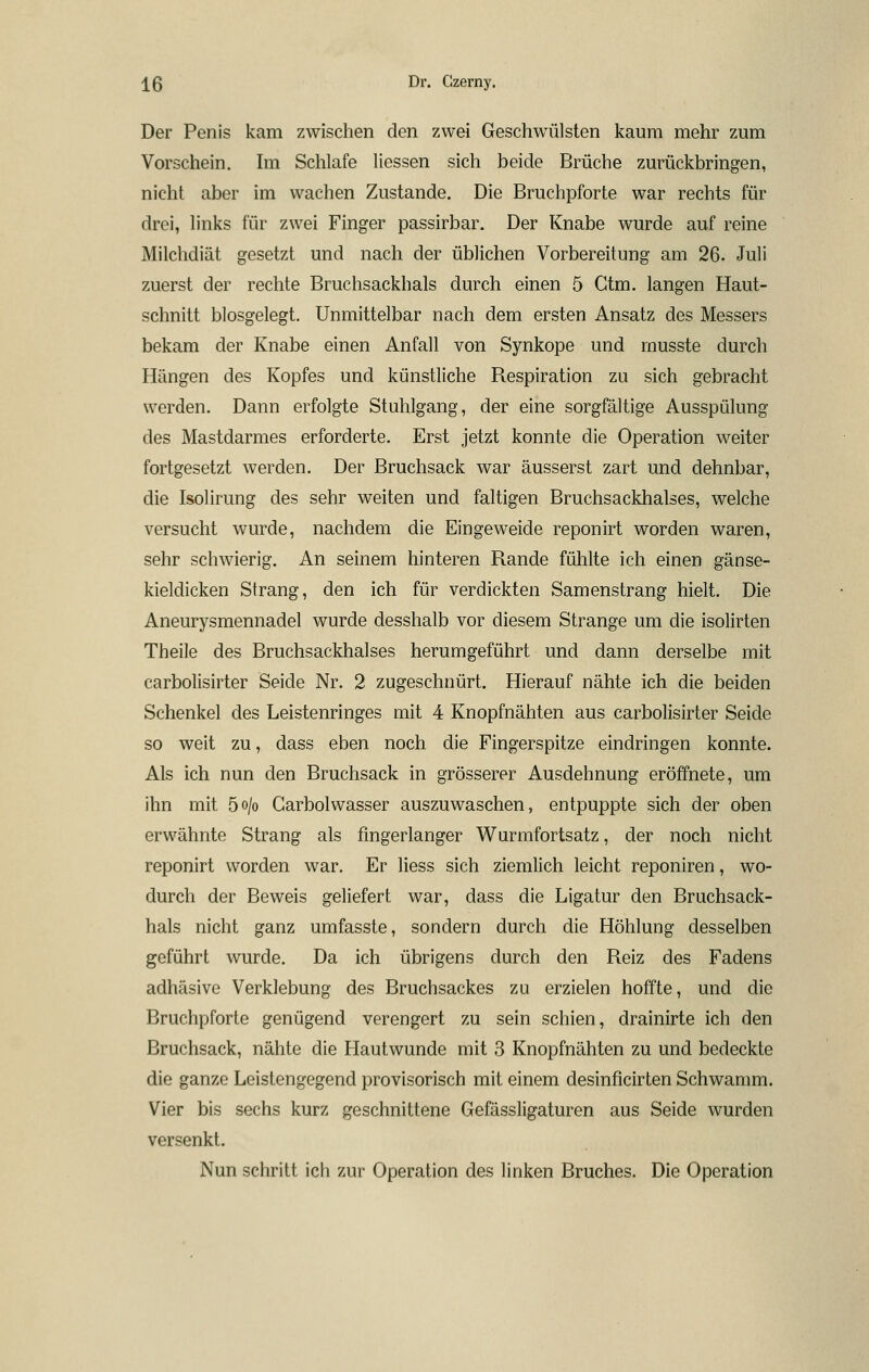 Der Penis kam zwischen den zwei Geschwülsten kaum mehr zum Vorschein. Im Schlafe Hessen sich beide Brüche zurückbringen, nicht aber im wachen Zustande. Die Bruchpforte war rechts für drei, links für zwei Finger passirbar. Der Knabe wurde auf reine Milchdiät gesetzt und nach der üblichen Vorbereitung am 26. Juli zuerst der rechte Bruchsackhals durch einen 5 Ctm. langen Haut- schnitt blosgelegt. Unmittelbar nach dem ersten Ansatz des Messers bekam der Knabe einen Anfall von Synkope und musste durch Hängen des Kopfes und künstliche Respiration zu sich gebracht werden. Dann erfolgte Stuhlgang, der eine sorgfältige Ausspülung des Mastdarmes erforderte. Erst jetzt konnte die Operation weiter fortgesetzt werden. Der Bruchsack war äusserst zart und dehnbar, die Isolirung des sehr weiten und faltigen Bruchsackhalses, welche versucht wurde, nachdem die Eingeweide reponirt worden waren, sehr schwierig. An seinem hinteren Rande fühlte ich einen gänse- kieldicken Strang, den ich für verdickten Samenstrang hielt. Die Aneurysmennadel wurde desshalb vor diesem Strange um die isolirten Theile des Bruchsackhalses herumgeführt und dann derselbe mit carbolisirter Seide Nr, 2 zugeschnürt. Hierauf nähte ich die beiden Schenkel des Leistenringes mit 4 Knopfnähten aus carbolisirter Seide so weit zu, dass eben noch die Fingerspitze eindringen konnte. Als ich nun den Bruchsack in grösserer Ausdehnung eröffnete, um ihn mit 5o/o Garbolwasser auszuwaschen, entpuppte sich der oben erwähnte Strang als fingerlanger Wurmfortsatz, der noch nicht reponirt worden war. Er Hess sich ziemlich leicht reponiren, wo- durch der Beweis geliefert war, dass die Ligatur den Bruchsack- hals nicht ganz umfasste, sondern durch die Höhlung desselben geführt wurde. Da ich übrigens durch den Reiz des Fadens adhäsive Verklebung des Bruchsackes zu erzielen hoffte, und die Bruchpforte genügend verengert zu sein schien, drainirte ich den ßruchsack, nähte die H^autwunde mit 3 Knopfnähten zu und bedeckte die ganze Leistengegend provisorisch mit einem desinficirten Schwamm. Vier bis sechs kurz geschnittene Gefässligaturen aus Seide wurden versenkt. Nun schritt ich zur Operation des linken Bruches. Die Operation