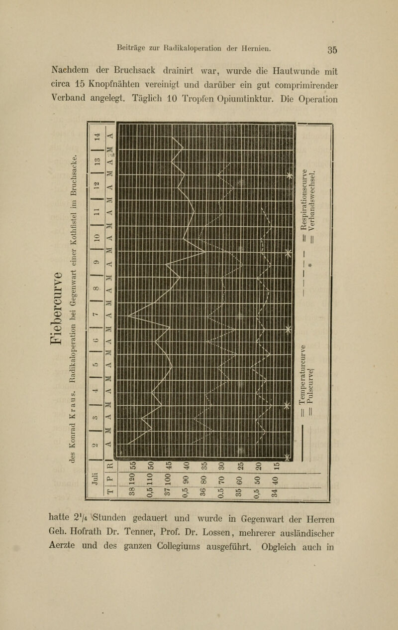 Nachdem der Bruchsack drainirt war, wurde die Hautwunde mit circa 15 Knopfnähten vereinigt und darüber ein gut comprimirender Verband angelegt. Täglicli 10 Tropfen Opiumtinktur. Die Operation PQ W .2 I M W I II II < 11 11 n n II 11 I I I lU IIH ■B II Sil ~ SS!I li im lliS U H ni in im r- <D O & cc 1^ ^ 1 (M (N rH -1 ,-1 ili «3» »O^ tO »O lO o ■«* hatte 2'/* «Stunden gedauert und wurde in Gegenwart der Herren Geh. Hofrath Dr. Tenner, Prof. Dr. Lossen, mehrerer auskändischer Aerzte und des ganzen Gollegiums ausgeführt. Obgleich auch in