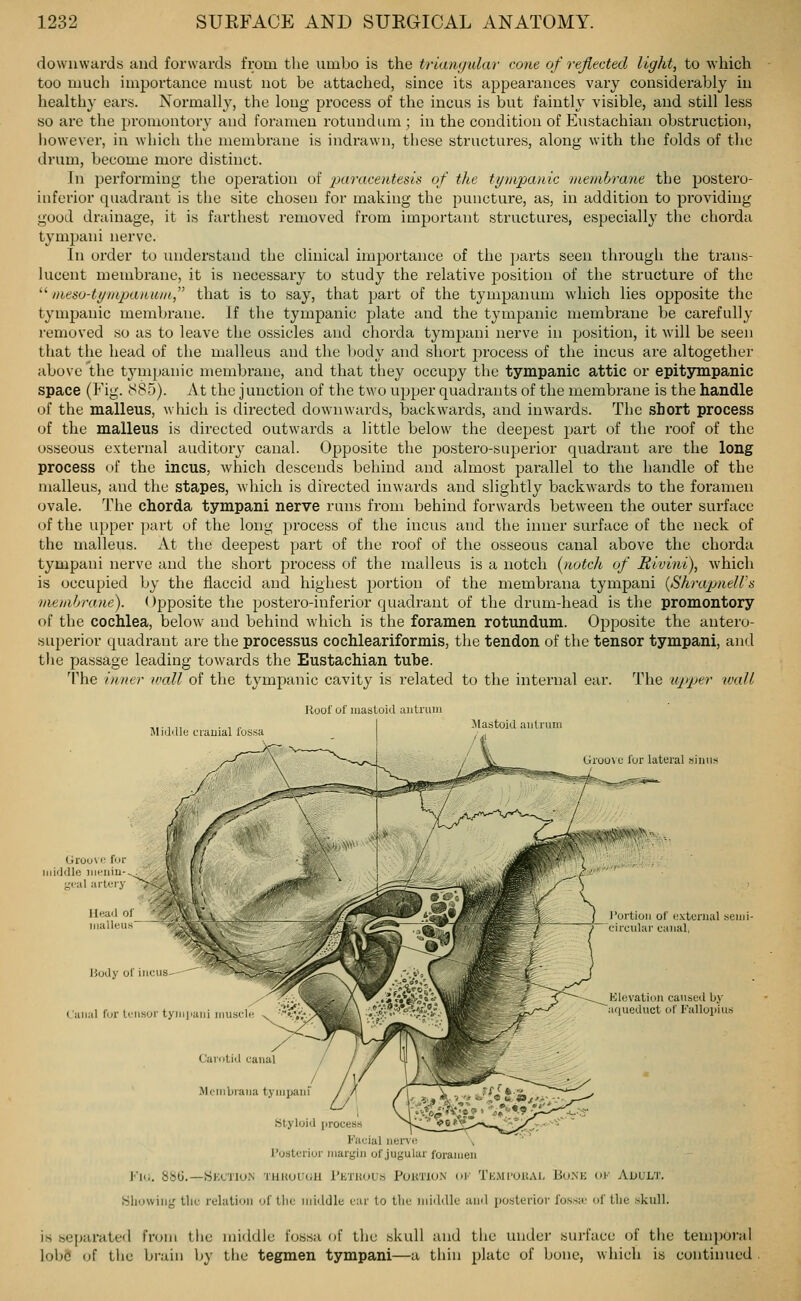 downwards and forwards from the umbo is the trianyular cone of reflected light, to which too much importance must not be attached, since its appearances vary considerably in healthy ears. Normally, the long process of the incus is but faintly visible, and still less so are the promontory and foramen rotundum; in the condition of Eustachian obstruction, however, in which the membrane is indrawn, these structures, along with the folds of the drum, become more distinct. In performing the operation of 'parace)itesis of the tympcudc membrane the postero- inferior quadrant is the site chosen for making the puncture, as, in addition to providing good drainage, it is farthest removed from important structures, especially the chorda tympani nerve. In order to understand the clinical importance of the parts seen through the trans- lucent membrane, it is necessary to study the relative position of the structure of the  »ieso-ti/mjKiHii/H, that is to say, that part of the tympanum which lies opposite the tympanic membrane. If the tympanic plate and the tympanic membrane be carefully removed so as to leave the ossicles and chorda tympani nerve in position, it will be seen that the head of the malleus and the l)ody and short j)rocess of the incus are altogether above the tympanic membrane, and that they occupy the tympanic attic or epitympanic space (Fig. J^'By). At the junction of the two upper quadrants of the membrane is the handle of the malleus, which is directed downwards, backwards, and inwards. The short process of the malleus is directed outwards a little below the deepest part of the roof of the osseous external auditory canal. Opposite the postero-superior quadrant are the long process of the incus, which descends behind and almost parallel to the handle of the malleus, and the stapes, which is directed inwards and slightly backwards to the foramen ovale. The chorda tympani nerve runs from behind forwards between the outer surface of the upper part of the long process of the incus and the inner surface of the neck of the malleus. At the deepest part of the roof of the osseous canal above the chorda tympani nerve and the short process of the malleus is a notch {notch of Rivini), which is occupied by the flaccid and highest portion of the membrana tympani {ShrajmeH's vieinbrmie). Opposite the postero-inferior quadrant of the drum-head is the promontory of the cochlea, below and behind which is the foramen rotundum. Opposite the antero- superior quadrant are the processus cochleariformis, the tendon of the tensor tympani, and the passage leading towards the Eustachian tube. The inner ivall of the tympanic cavity is related to the internal ear. The upper ivall Roof of luasloid uutniiu MiiJiUu ciauial fossa -Mastoid aiitrum Gioo\ u for lateral sinus Uroovi; for iiiirldlc iiieiiiu-^. goal arteiy 7<^' Head of^ ' / X?. V '. malleus Body of iucus- I'aiial for Iriisor tyiiijiaMi ijiusc I'ortioii of i.'xtcrnal .seiui- circular canal, Elevation caused by ;iqueduct of Fallopius Carotid canal Menibiana tj njijani Styloid process Facial nerve I'oslcrior margin of jugular foramen Fllj. 886.—hjKCTlON THKUUGU I'KTUOUS POKTION OF TkMI'UUAI. BuNE OK ADULT. Sliowiiig tlic relation of tlie middle ear to the iniildle anil posterioi- foss;r of tlie skull. is separated from the middle fossa of the skull and the under surface of the temporal lobe! of the brain by the tegmen tympani—a thin plate of bone, which is continued