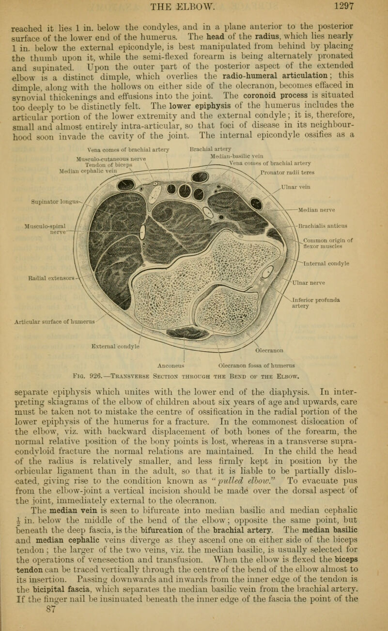 reached it lies 1 iu. below the condyles, and in a plane anterior to the posterior surface of the lower end of the humerus. The head of the radius, which lies nearly 1 in. below the external epicondyle, is best manipulated from behiud by placin-^' the thumb upon it, while the semi-flexed forearm is being alternately pronated and supinated. Upon the outer part of the posterior aspect of the extended elbow is a distinct dimple, which overlies the radio-humeral articulation; this dimple, aloncj with the hollows on either side of the olecranon, becouies etfaced in synovial thickenings and effusions into the joint. The coronoid process is situated too deeply to be distinctly felt. The lower epiphysis of the humerus includes the articular portion of the lower extremity and the external condyle; it is, therefore, small and almost entirely intra-articular, so that foci of disease in its neighbour- hood soon invade the cavity of the joint. The internal epicondyle ossifies as a Vena comes of brachial artery Musculo-cutaneous nerve Tendon of biceps Median cephalic vein Brachial artery Metliau-basilic vein ' / Vena conies of brachial artery Pronator radii teres Supinator longus- Musculo-spiral // nerve fj- Radial extensors - Articular surface of humerus Median nerve Brachialis anticus Common origin of rtexor muscles Internal condyle Ulnar nerve \Inferior profunda artery External condj le Olecranon Fig. 926. Anconeus Olecranon fossa of humerus -Traxsyeese Sectiox through the Bend of the Elbow. separate epiphysis which unites with the lower end of the diaphysis. In inter- preting skiagrams of the elbow of children about six years of age and upwards, care must be taken not to mistake the centre of ossification in the radial portion of the lower epiphysis of the humerus for a fracture. In the commonest dislocation of the elbow, viz. with backward displacement of both bones of the forearm, the normal relative position of the bony points is lost, whereas in a transverse supra- condyloid fracture the normal relations are maintained. In the child the head of the radius is relatively smaller, and less firmly kept in position by the orbicular ligament than in the adult, so that it is liable to be partially dislo- cated, giving rise to the condition kno^vn as pulled elhoiv. To evacuate pus from the elbow-joint a vertical incision should be made over the dorsal aspect of the joint, immediately external to the olecranon. The median vein is seen to bifurcate into median basilic and median cephalic h in. below the middle of the Ijend of the elbow; opposite the same point, but beneath the deep fascia, is the bifurcation of the brachial artery. The median basilic ^nd median cephalic veins diverge a? they ascend one on either side of the biceps tendon ; the larger of the two veins, viz. the median basilic, is usually selected for the operations of venesection and transfusion. When the elbow is flexed the biceps tendon can be traced vertically through the centre of the bend of the elbow almost to its insertion. Passing downwards and inwards from the inner edge of the tendon is the bicipital fascia, which separates the median basilic vein from the l^rachial artery. If the fin!j;er nail be insinuated beneath the inner edge of the fascia the point of the