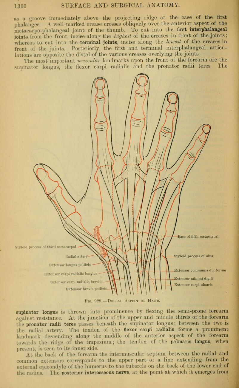 as a groove immediately above the projecting ridge at the base of the first phalanges. A well-marked crease crosses obliquely over the anterior aspect of the metaearpo-phalangeal joint of the thumb. To cut into the first interphalangeal joints from the front, incise along the highest of the creases in front of the joints; whereas to cut into the terminal joints, incise along the loioesi of the creases in front of the joints. Posteriorly, the first and terminal interphalangeal articu- lations are opposite the distal of the various creases overlying the joints. The most important muscular landmarks upon the front of the forearm are the supinator lougus, the flexor carpi radialis and the pronator radii teres. The Styloiil process of third metacarpal ItaJial artery Extensor longus pollicis Extensor carpi radialis longior Extensor carpi radialis bre\') Base of fifth metacarpal Styloid process of ulna Extensor communis digitorum Extensor minimi digiti Extensor carpi ulnaris Extensor brevis pollicis^ Fig. 929.—Dorsal Aspect of Hand. supinator longus is thrown into prominence by flexing the semi-prone forearm against resistance. At the junction of the upyjer and middle thirds of the forearm the pronator radii teres passes beneath the supinator longus; between the two is the radial artery. The tendon of the flexor carpi radialis forms a prominent landmark descending along the middle of the anterior aspect of the forearm towards the ridge of the trapezium; the tendon of tlie palmaris longus, when present, is seen to its inner side. At the back of the forearm the intermuscular septum between tlie radial and common extensors corresponds to the upper part of a line extending from the external epicondyle of the humerus to the tubercle on the back of the lower end of the radius. The posterior interosseous nerve, at the point at which it emerges from