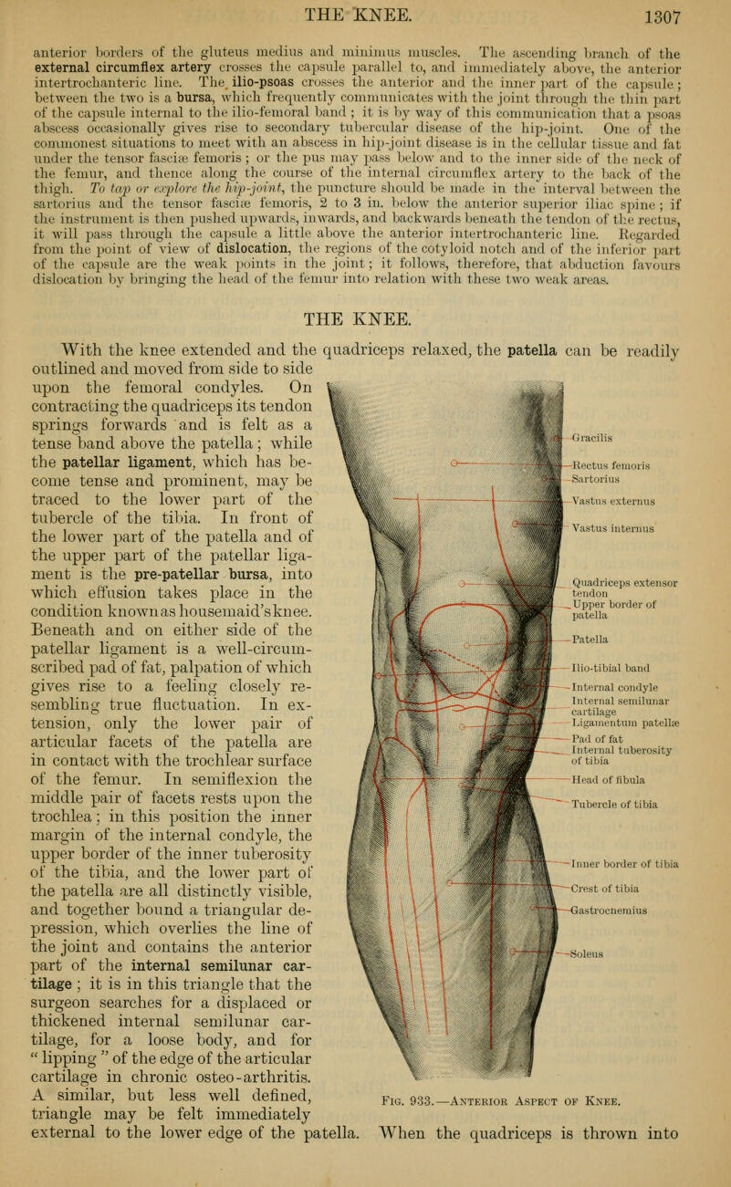 anterior borders of the gluteus meclius and mininuis muscles. The ascending branch of the external circumflex artery crosses the capsule parallel to, and inmiediately above, the anterior intertrochanteric line. The ilio-psoas crosses the anterior and the inner jjart of the cajisule ; between the two is a bursa, which frequently communicates with the joint througli the tliin ])art of the capsule internal to the ilio-femoral band ; it is by way of this communication that a jjsoas abscess occasionally gives rise to secondary tubercular disease of tlie liip-joint. One of the commonest situations to meet with an abscess in hip-joint disease is in the cellular tissue and fat under the tensor fascite femoris ; or the pus may pass below and to the inner side; of the neck of the femur, and thence along the course of the internal circumflex artery to the liack of the thigh. To tap or explore the hip-joint, the i^uncture should be made in the interval between the sartorius and the tensor fascife femoris, 2 to 3 in. l)elow the anterior superior iliac S2:)ine ; if the instrument is then pushed upwards, inwards, and backwards Ijeneath the tendon of the rectus, it will pass througli tlie capsule a little above the anterior intertrochanteric line. Regarded from the point of view of dislocation, the regions of the cotyloid notch and of the inferior jiart of the capsule are the weak points in the joint; it follows, therefore, that abduction favours dislocation by bringing the head of the femur into relation with these two weak areas. THE KNEE. With the knee extended and the quadriceps relaxed, the patella can be readily outlined and moved from side to side upon the femoral condyles. On contracting the quadriceps its tendon springs forwards and is felt as a tense band above the patella ; while the patellar ligament, which has be- come tense and prominent, may be traced to the lower part of the tubercle of the tibia. In front of the lower part of the patella and of the upper part of the patellar liga- ment is the pre-patellar bursa, into which effusion takes place in the condition known as housemaid'sknee. Beneath and on either side of the patellar ligament is a well-circum- scribed pad of fat, palpation of which gives rise to a feeling closely re- sembling true fluctuation. In ex- tension, only the lower pair of articular facets of the patella are in contact with the trochlear surface of the femur. In semiflexion the middle pair of facets rests upon the trochlea; in this position the inner margin of the internal condyle, the upper border of the inner tuberosity of the tibia, and the low^er part of the patella are all distinctly visible, and together bound a triangular de- pression, which overlies the line of the joint and contains the anterior part of the internal semilunar car- tilage ; it is in this triangle that the surgeon searches for a displaced or thickened internal semilunar car- tilage, for a loose body, and for  lipping  of the edge of the articular cartilage in chronic osteo-arthritis. A similar, but less well defined, triangle may be felt immediately external to the lower edge of the patella Gracilis Rectus femoris Sartorius Vastus externus Vastus interims Quadriceps extensor tendon Upper border of patella Patella Uio-tibial band Internal condyle Internal semilunar cartilage Ligamentuui jjatellse Pad of fat Internal tuberosity of tibia Head of fibula Tubercle of tibia — Inner border of tibia Crest of tibia Gastrocnemius Soleus Fig. 933.—Anterior Aspect of Knee. When the quadriceps is thrown into