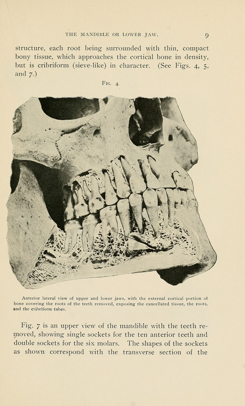 structure, each root being surrounded with thin, compact bony tissue, which approaches the cortical bone in density, but is cribriform (sieve-Hke) in character. (See Figs. 4, 5, and 7.) Fig. 4. ki4s<v>!V- Anterior lateral view of upper and lower jaws, with the external cortical portion of bone covering the roots of the teeth removed, exposing the cancellated tissue, the roots, and the cribriform tubes. Fig. 7 is an upper view of the mandible with the teeth re- moved, showing single sockets for the ten anterior teeth and double sockets for the six molars. The shapes of the sockets as shown correspond with the transverse section of the