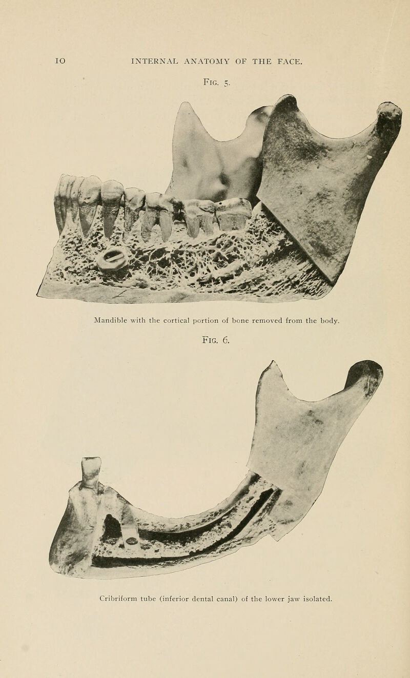 Fig. ^. Mandible with the cortical portion of bone removed from the body. Fig. 6. Cribriform tube (inferior dental canal) of the lower jaw isolated.