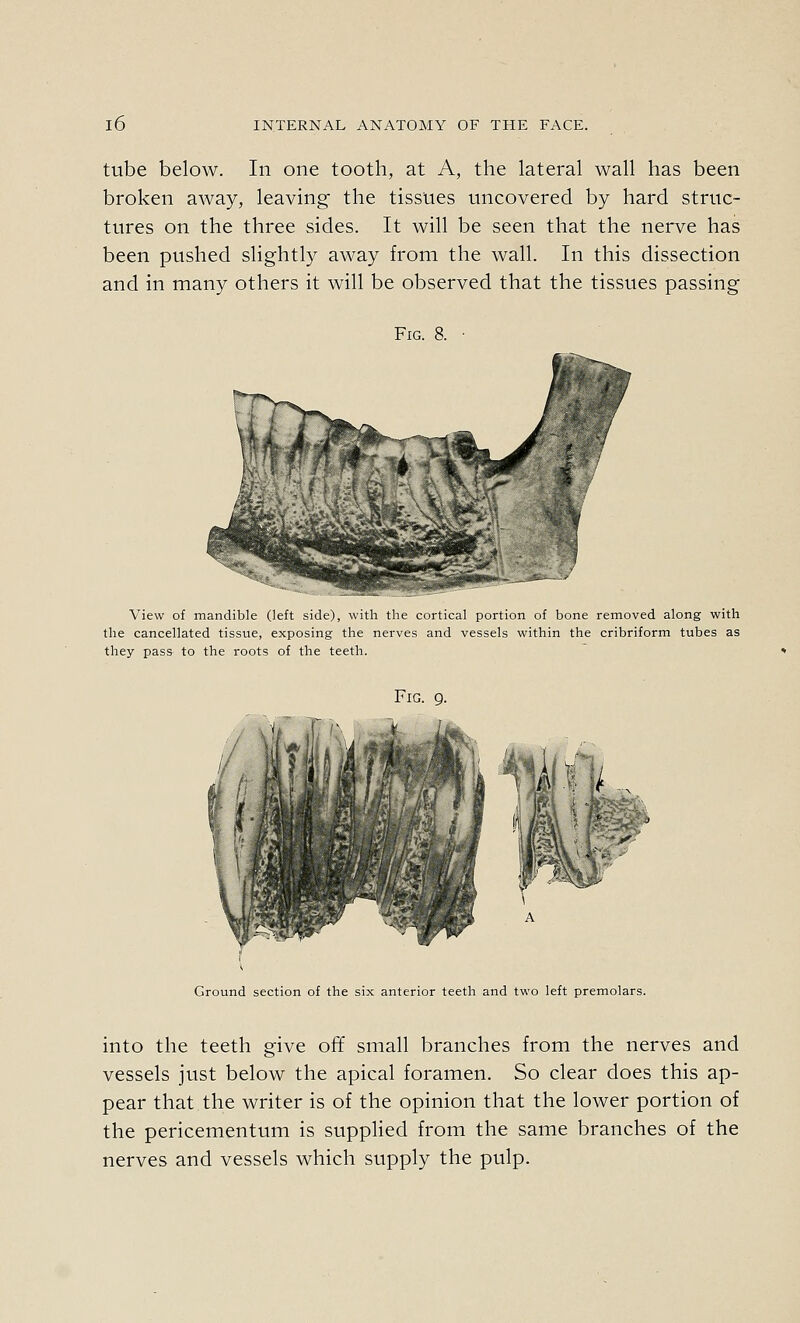 tube below. In one tooth, at A, the lateral wall has been broken away, leaving the tissues uncovered by hard struc- tures on the three sides. It will be seen that the nerve has been pushed slightly away from the wall. In this dissection and in many others it will be observed that the tissues passing Fig. 8. View of mandible (left side), with the cortical portion of bone removed along with the cancellated tissue, exposing the nerves and vessels within the cribriform tubes as they pass- to the roots of the teeth. Fig. g. Ground section of the six anterior teeth and two left premolars. into the teeth give off small branches from the nerves and vessels just below the apical foramen. So clear does this ap- pear that the writer is of the opinion that the lower portion of the pericementum is supplied from the same branches of the nerves and vessels which supply the pulp.