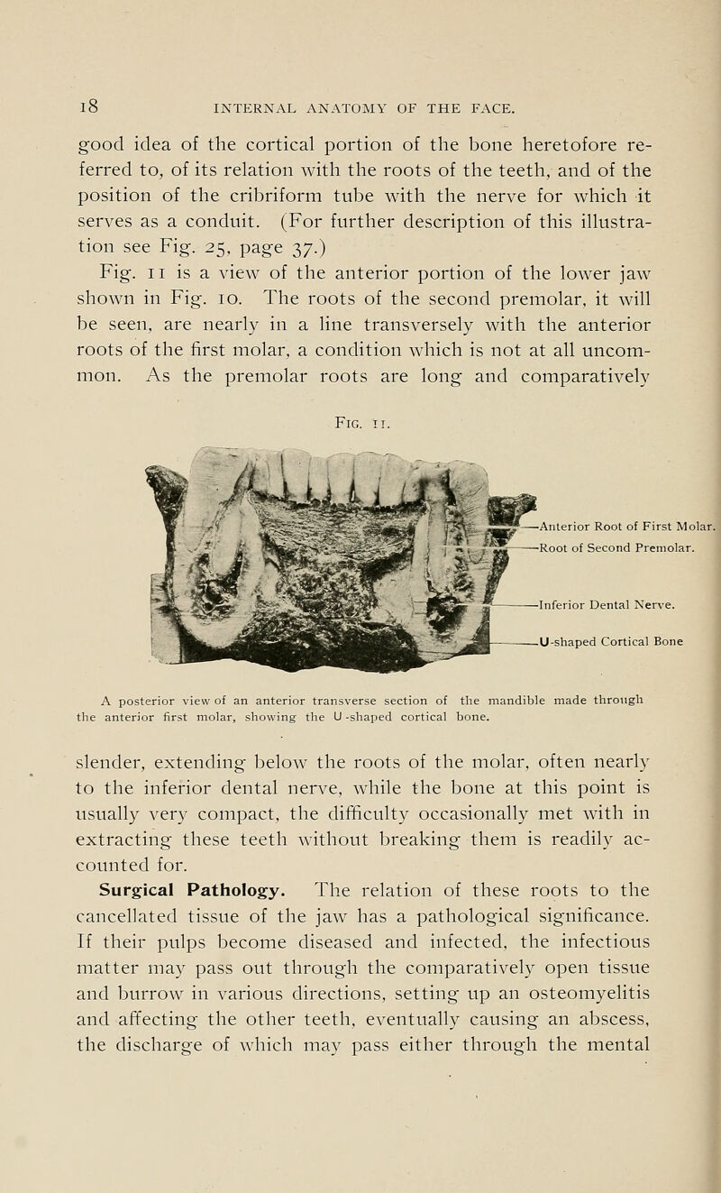 good idea of the cortical portion of the bone heretofore re- ferred to, of its relation with the roots of the teeth, and of the position of the cribriform tube with the nerve for which it serves as a conduit. (For further description of this illustra- tion see Fig. 25, page 37.) Fig. II is a view of the anterior portion of the lower jaw shown in Fig. 10. The roots of the second premolar, it will be seen, are nearly in a line transversely with the anterior roots of the first molar, a condition which is not at all uncom- mon. As the premolar roots are long and comparatively Fig. II. Anterior Root of First Molar. Root of Second Premolar. Inferior Dental Nerve. U-shaped Cortical Bone A posterior view of an anterior transverse section of the mandible made through the anterior first molar, showing the U -shaped cortical bone. slender, extending below the roots of the molar, often nearly to the inferior dental nerve, while the bone at this point is usually very compact, the difficulty occasionally met with in extracting these teeth without breaking them is readily ac- counted for. Surgical Pathology. The relation of these roots to the cancellated tissue of the jaw has a pathological significance. If their pulps become diseased and infected, the infectious matter may pass out through the comparatively open tissue and burrow in various directions, setting up an osteomyelitis and affecting the other teeth, eventually causing an abscess, the discharge of which may pass either through the mental