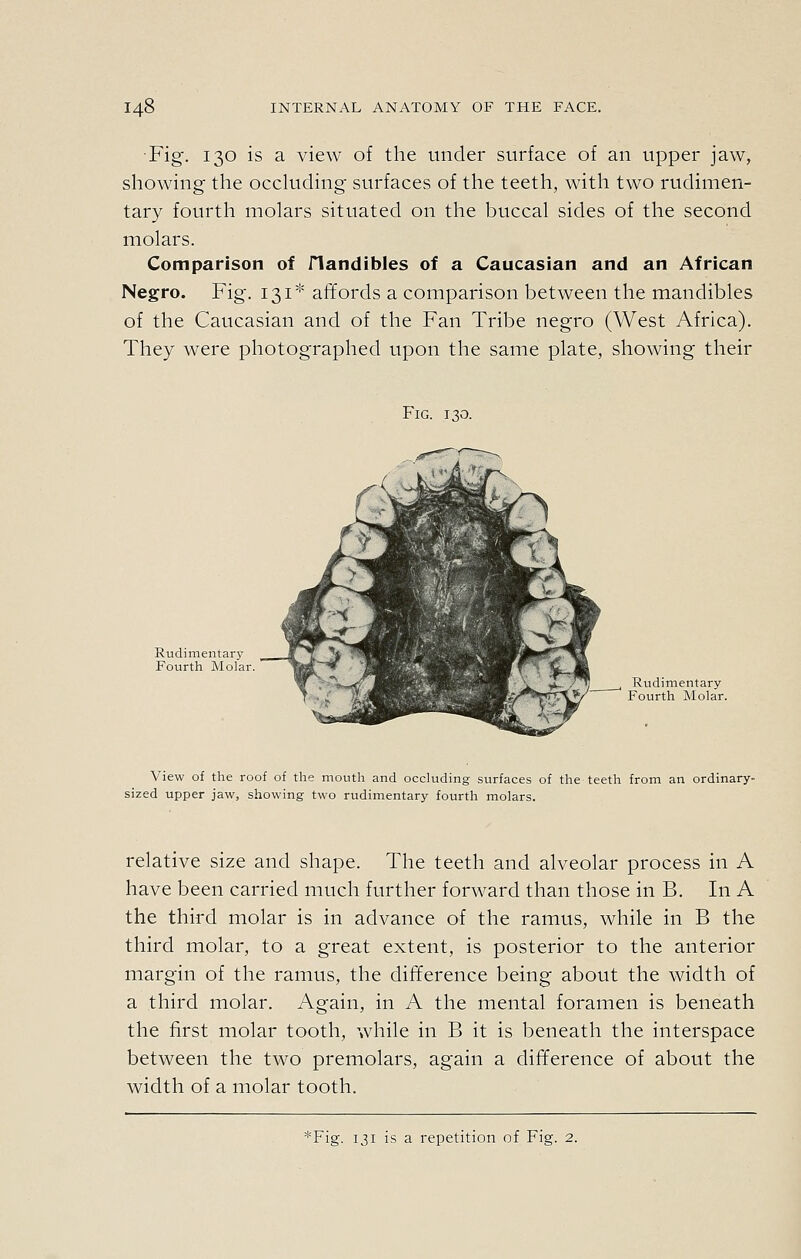 Fig. 130 is a view of the under surface of an upper jaw, showing the occluding surfaces of the teeth, with two rudimen- tary fourth molars situated on the buccal sides of the second molars. Comparison of flandibles of a Caucasian and an African Negro. Fig. 131''' affords a comparison between the mandibles of the Caucasian and of the Fan Tribe negro (West Africa). They were photographed upon the same plate, showing their Fig. 130. Rudimentary Fourth Molar. Rudimentary Fourth Molar. View of the roof of the mouth and occluding surfaces of the teeth from an ordinary- sized upper jaw, showing two rudimentary fourth molars. relative size and shape. The teeth and alveolar process in A have been carried much further forward than those in B. In A the third molar is in advance of the ramus, while in B the third molar, to a great extent, is posterior to the anterior margin of the ramus, the difference being about the width of a third molar. Again, in A the mental foramen is beneath the first molar tooth, while in B it is beneath the interspace between the two premolars, again a difference of about the width of a molar tooth. *Fig. 131 is a repetition of Fig. 2.