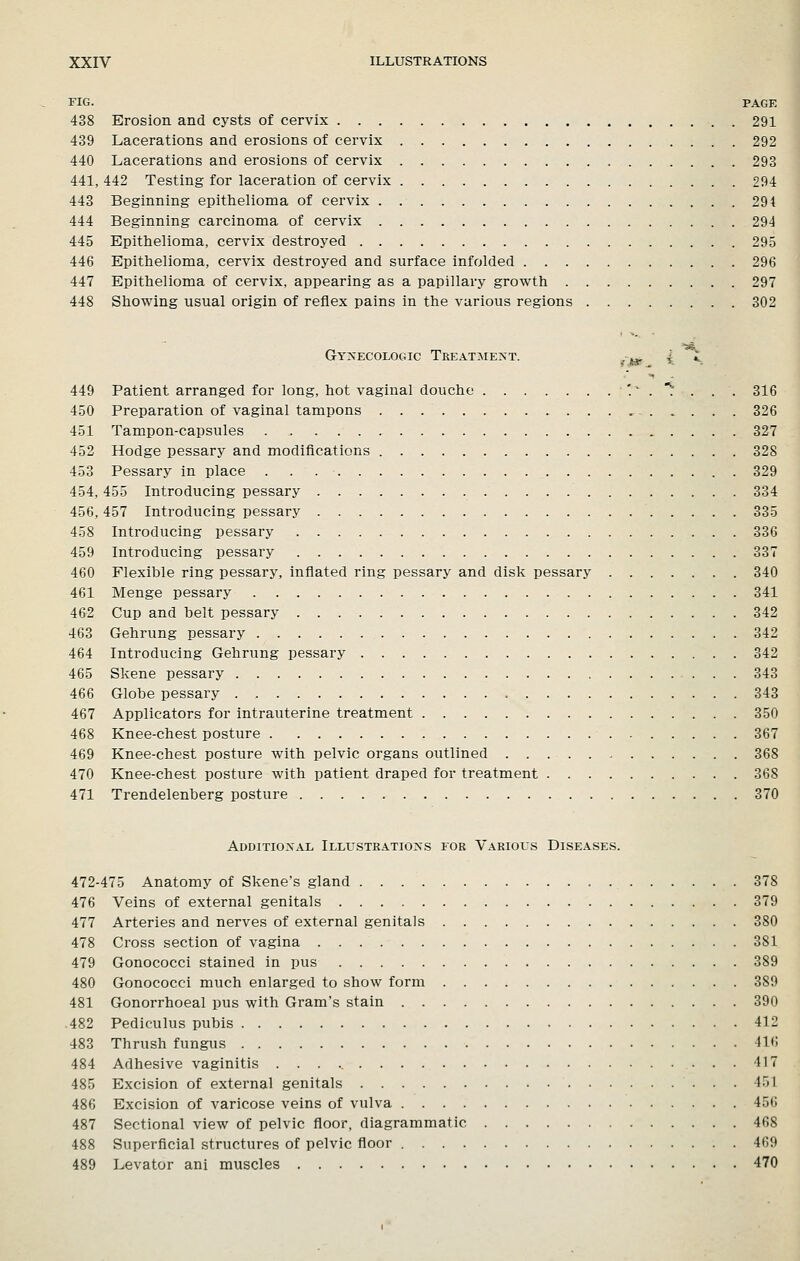 FIG. PAGE 438 Erosion and cysts of cervix 291 439 Lacerations and erosions of cervix 292 440 Lacerations and erosions of cervix 293 441, 442 Testing for laceration of cervix 294 443 Beginning epithelioma of cervix 294 444 Beginning carcinoma of cervix 294 445 Epithelioma, cervix destroyed 295 446 Epithelioma, cervix destroyed and surface infolded 296 447 Epithelioma of cervix, appearing as a papillary growth 297 448 Showing usual origin of reflex pains in the various regions 302 Gynecologic Treatment. ^-jj^p 4 v 449 Patient arranged for long, hot vaginal douche '' . ^ . . . 316 450 Preparation of vaginal tampons , 326 451 Tampon-capsules 327 452 Hodge pessary and modifications 328 453 Pessary in place . . 329 454,455 Introducing pessary 334 456,457 Introducing pessary 335 458 Introducing pessary 336 459 Introducing pessary 337 460 Flexible ring pessary, inflated ring pessary and disk pessary 340 461 Menge pessary 341 462 Cup and belt pessary 342 463 Gehrung pessary 342 464 Introducing Gehrung pessary 342 465 Skene pessary 343 466 Globe pessary 343 467 Applicators for intrauterine treatment 350 468 Knee-chest posture 367 469 Knee-chest posture with pelvic organs outlined 368 470 Knee-chest posture with patient draped for treatment 368 471 Trendelenberg posture 370 Additional Illustrations for Various Diseases. 472-475 Anatomy of Skene's gland 378 476 Veins of external genitals 379 477 Arteries and nerves of external genitals 380 478 Cross section of vagina 381 479 Gonococci stained in pus 389 480 Gonococci much enlarged to show form 389 481 Gonorrhoeal pus with Gram's stain 390 .482 Pediculus pubis 412 483 Thrush fungus 416 484 Adhesive vaginitis 417 485 Excision of external genitals 451 486 Excision of varicose veins of vulva 456 487 Sectional view of pelvic floor, diagrammatic 468 488 Superficial structures of pelvic floor 469 489 Levator ani muscles 470