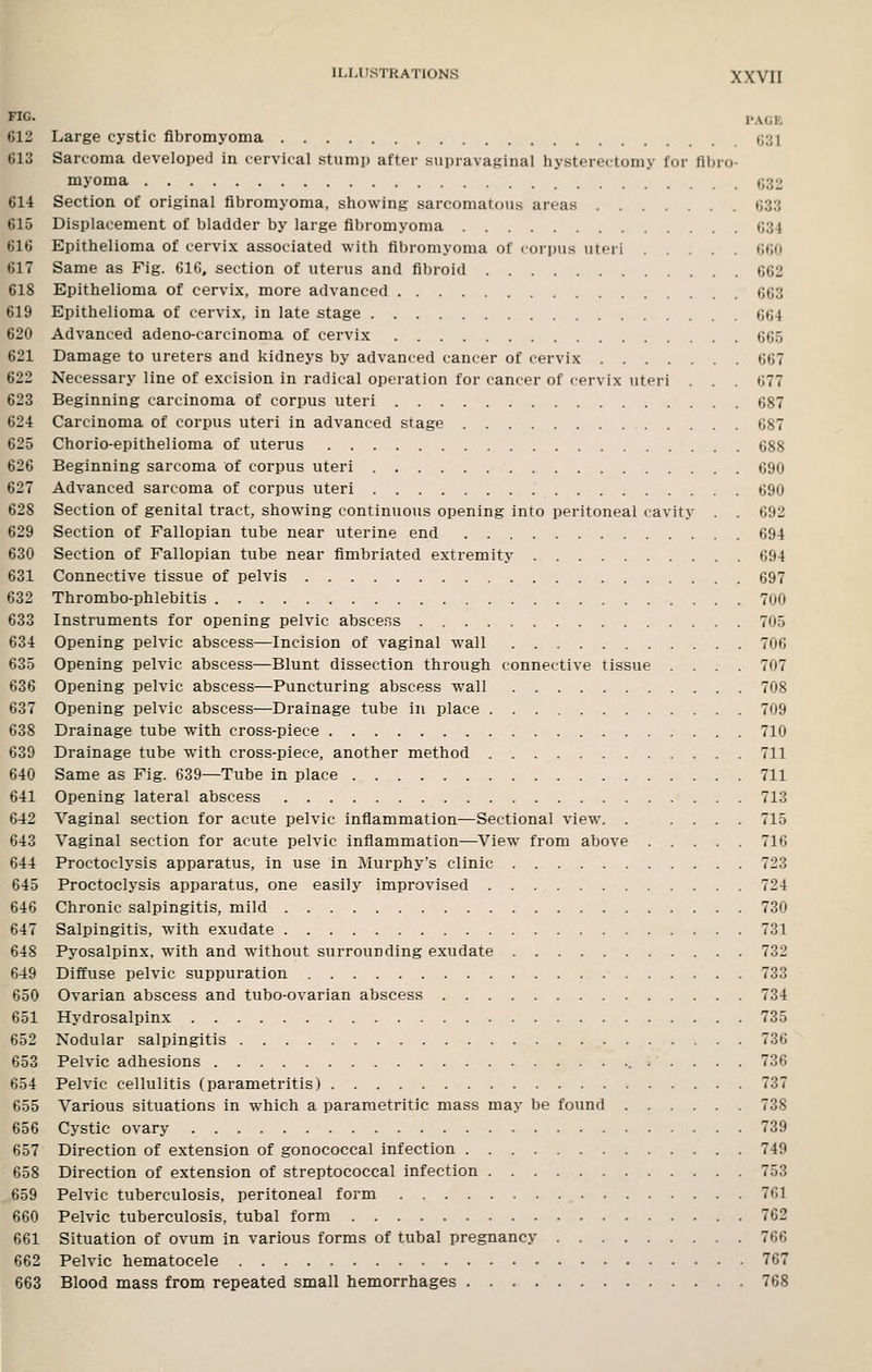 PAGE Large cystic fibromyoma tj31 Sarcoma developed in cervical stump after supravaginal hysterectomy for fibro- myoma 032 Section of original fibromyoma. showing sarcomatous areas 633 Displacement of bladder by large fibromyoma 034 Epithelioma of cervix associated with fibromyoma of corpus uteri (j60 Same as Fig. 616, section of uterus and fibroid 662 Epithelioma of cervix, more advanced 663 Epithelioma of cervix, in late stage 664 Advanced adeno-carcinoma of cervix 665 Damage to ureters and kidneys by advanced cancer of cervix 667 Necessary line of excision in radical operation for cancer of cervix uteri . . . 677 Beginning carcinoma of corpus uteri 687 Carcinoma of corpus uteri in advanced stage 687 Chorio-epithelioma of uterus 688 Beginning sarcoma of corpus uteri 690 Advanced sarcoma of corpus uteri 690 Section of genital tract, showing continuous opening into peritoneal cavity . . 692 Section of Fallopian tube near uterine end 694 Section of Fallopian tube near fimbriated extremity 694 Connective tissue of pelvis 697 Thrombo-phlebitis 700 Instruments for opening pelvic abscess 705 Opening pelvic abscess—Incision of vaginal wall 706 Opening pelvic abscess—Blunt dissection through connective tissue .... 707 Opening pelvic abscess—Puncturing abscess wall 708 Opening pelvic abscess—Drainage tube in place 709 Drainage tube with cross-piece 710 Drainage tube with cross-piece, another method 711 Same as Fig. 639—Tube in place 711 Opening lateral abscess 713 Vaginal section for acute pelvic inflammation—Sectional view. . .... 715 Vaginal section for acute pelvic inflammation—View from above 716 Proctoclysis apparatus, in use in Murphy's clinic 723 Proctoclysis apparatus, one easily improvised 724 Chronic salpingitis, mild 730 Salpingitis, with exudate 731 Pyosalpinx, with and without surrounding exudate 732 Diffuse pelvic suppuration 733 Ovarian abscess and tubo-ovarian abscess 734 Hydrosalpinx 735 Nodular salpingitis 736 Pelvic adhesions 736 Pelvic cellulitis (parametritis) 737 Various situations in which a parametritic mass may be found 738 Cystic ovary 739 Direction of extension of gonococcal infection 749 Direction of extension of streptococcal infection 753 Pelvic tuberculosis, peritoneal form 761 Pelvic tuberculosis, tubal form 762 Situation of ovum in various forms of tubal pregnancy 766 Pelvic hematocele 767 Blood mass from repeated small hemorrhages 768