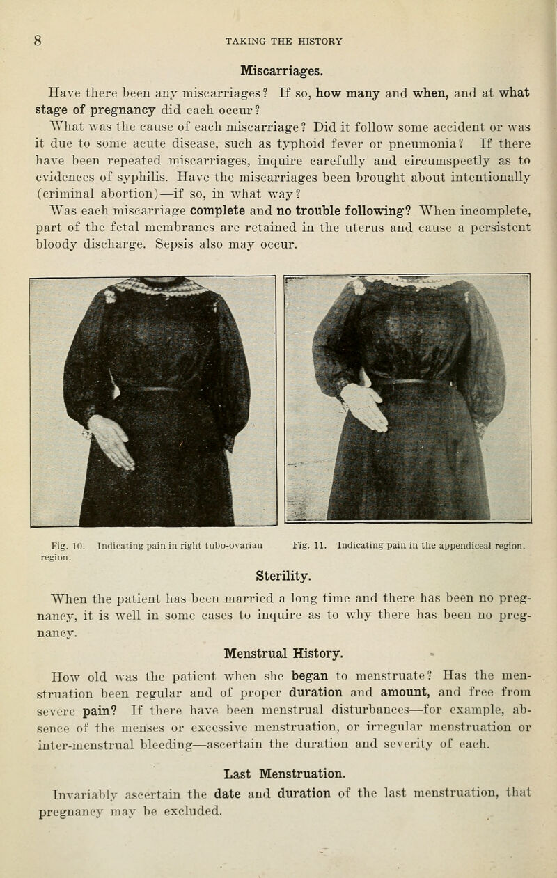 Miscarriages. Have there been any miscarriages ? If so, how many and when, and at what stage of pregnancy did each occur ? A\hat was the cause of each miscarriage? Did it follow some accident or was it due to some acute disease, such as typhoid fever or pneumonia? If there have been repeated miscarriages, inquire carefully and circumspectly as to evidences of syphilis. Have the miscarriages been brought about intentionally (criminal abortion)—if so, in what way? Was each miscarriage complete and no trouble following? When incomplete, part of the fetal membranes are retained in the uterus and cause a persistent bloody discharge. Sepsis also may occur. Fig. 10. region. Indicating pain in right tubo-ovarian Fig. 11. Indicating pain in tlie appendiceal region. Sterility. When the patient has been married a long time and there has been no preg- nancy, it is well in some cases to inquire as to why there has been no preg- nancy. Menstrual History. How old was the patient when she began to menstruate? Has the men- struation been regular and of proper duration and amount, and free from severe pain? If there have been menstrual disturbances—for example, ab- sence of the menses or excessive menstruation, or irregular menstruation or inter-menstrual bleeding—ascertain the duration and severity of each. Last Menstruation. Invariably ascertain the date and duration of the last menstruation, that pregnancy may be excluded.