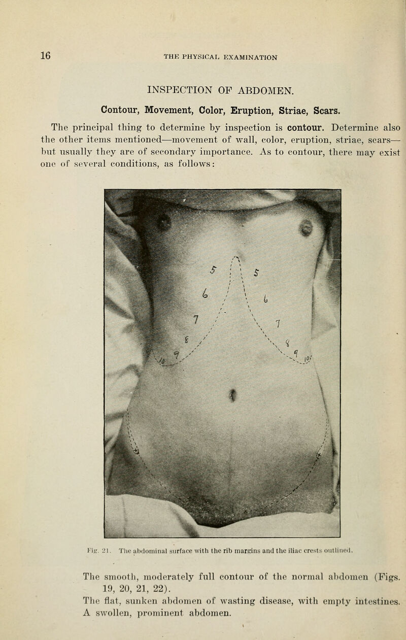 INSPECTION OF ABDOMEN. Contour, Movement, Color, Eruption, Striae, Scars. The principal thing to determine by inspection is contour. Determine also the other items mentioned—movement of wall, color, eruption, striae, scars— but usually they are of secondary importance. As to contour, there may exist one of several conditions, as follows: FiK. 21. The abdominal surface with the rib margins and the iliac crests outhned. The smootli, moderately full contour of tlie normal abdomen (Figs. 19, 20, 21, 22). The flat, sunken alxlomen of wasting disease, with empty intestines. A swollen, prominent abdomen.