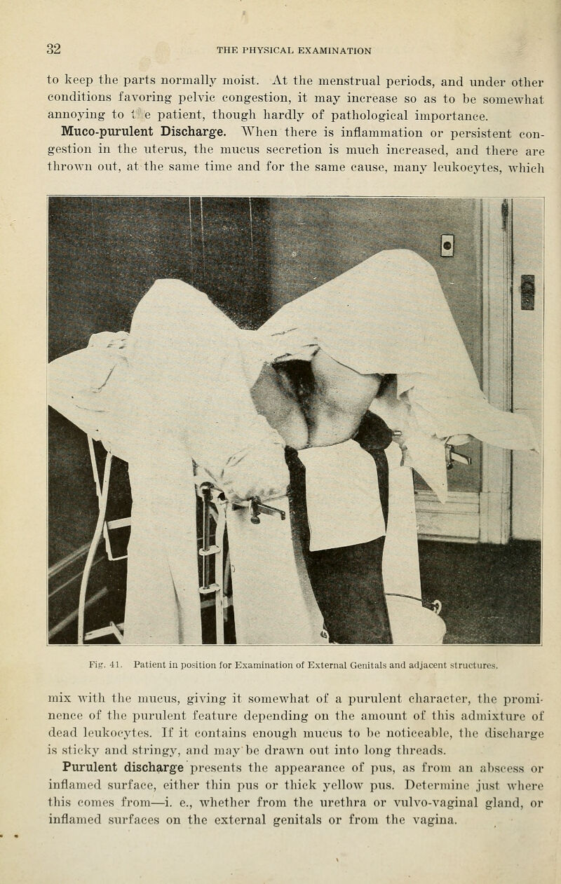 to keep the parts normally moist. At the menstrual periods, and under other conditions favoring pelvic congestion, it may increase so as to be somewhat annoying to 1 e patient, though hardly of pathological importance. Muco-purulent Discharge. AA^hen there is inflammation or persistent con- gestion in the uterus, the mucus secretion is much increased, and there are thrown out, at the same time and for the same cause, many leukocytes, which Fig. 41. Patient in position for Examination of External Genitals and adjacent structure.s. mix with the mucus, giving it somewhat of a purulent character, the promi- nence of the purulent feature depending on the amount of this admixture of dead leukocytes. If it contains enough mucus to be noticeable, the discharge is sticky and stringy, and may'be drawn out into long threads. Purulent discharge presents the appearance of pus, as from an abscess or inflamed surface, either thin pus or thick yellow pus. Determine just where this comes from—i. e., whether from the urethra or vulvo-vaginal gland, or inflamed surfaces on the external genitals or from the vagina.