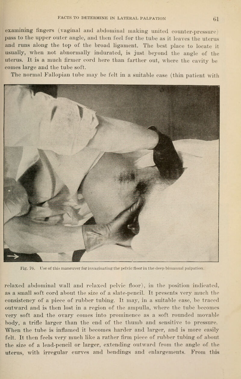 examining fingers (vaginal and aluloiuiual mailing united euunler-pressure) pass to tlie upper outer angle, ajid tlu'ii feel for the tube as it leaves the uterus and runs along the top of the broad ligament. The best place to locate it usually, when not abnormally indurated, is just beyond the angle of the uterus. It is a much firmer cord here than farther out, where the cavity be comes large and the tube soft. The normal Fallopian lube may be felt in a suita])le ease (thin patient with Fig. 70. T'se of this maneuver forinvatrinating the ])elvic floor in tlie lieep biniainiul pulpatii relaxed abdominal wall and i-elaxed pelvic floor), in the po.sitiou indicated, as a small soft cord about the size of a slate-pencil. It presents very much tlie consistency of a piece of rubber tubing. It may, in a suitable case, be traced outward and is then lost in a region of the ampulla, where the tube becomes very soft and the ovary comes into prominence as a soft rounded movable body, a trifle larger than the end of the thumb and sensitive to pressure. When the tube is inflamed it becomes harder and larger, and is more easily felt. It then feels very much like a rather firm piece of rubber tubing of about the size of a lead-pencil or larger, extending outward from the angle of the uterus, with irregular curves and bendings and enlargements. From thi.s