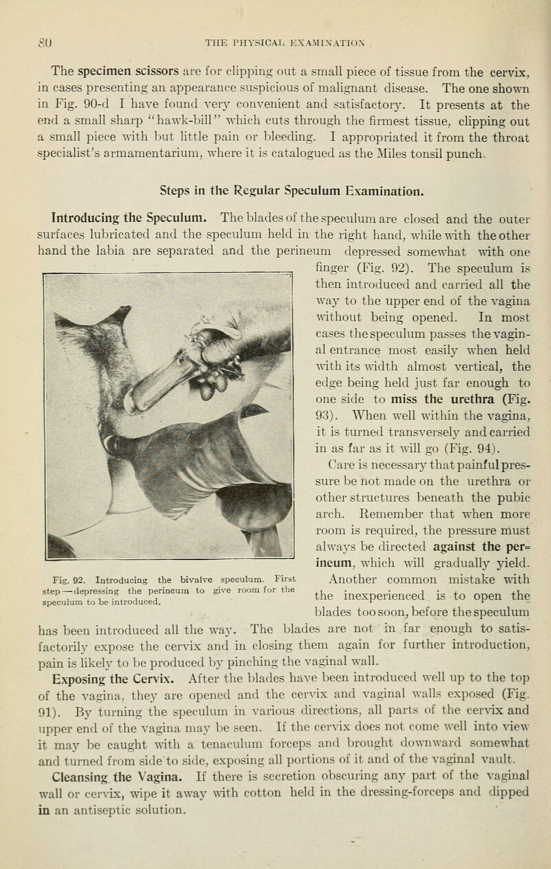 The specimen scissors are for clipping out a small piece of tissue from the cervix, in cases presenting an appearance suspicious of mahgnant disease. The one shown in Fig. 90-cl I have found very convenient and satisfactorJ^ It presents at the end a small sharp ''hawk-bill -^^liich cuts through the firmest tissue, clipping out a small piece udth but little pain or bleeding. I appropriated it from the throat specialist's armamentarium, where it is catalogued as the Miles tonsil punch. Steps in the Regular Speculum Examination. Introducing the Speculum. The blades of the speculum are closed and the outer surfaces lubricated and the speculum held in the right hand, while with the other hand the labia are separated and the perineum depressed somewhat with one finger (Fig. 92). The speculum is then introduced and carried all the way to the upper end of the vagina T^ithout being opened. In most cases the speculum passes the vagin- al entrance most easily when held with its width almost vertical, the edge being held just far enough to one side to miss the urethra (Fig. 93). When well within the vagina, it is turned transversely and carried in as far as it v\ill go (Fig. 94). Care is necessary that painful pres- sure be not made on the urethra or other structures beneath the pubic arch. Remember that when more room is required, the pressure must alwa3's be directed against the per= ineum, which mil gradually yield. Another common mistake with the inexperienced is to open the blades too soon^ before the speculum has been introduced all the way. The blades are not in far enough to satis- factorily expose the cervix and in closing them again for further introduction, pain is likely to be produced by pinching the vaginal wall. Exposing the Cervix. After the blades have been introduced well up to the top of the vagina, they are opened and the cervix and vaginal walls exposed (Fig. 91). By turning the speculum in various directions, all parts of the cer\dx and upper end of the vagina may be seen. If the cervix does not come well into view it may be caught vnth a tenaculum forceps and brought downward somewhat and turned from side'to side, exposing all portions of it and of the vaginal vault. Cleansing, the Vagina. If there is secretion obscuring any part of the vaginal wall or cer\-ix, wipe it away with cotton held in the dressing-forceps and dipped in an antiseptic solution. Fig. 92. Introducing the bivalve speculum. First step — depressing the perineum to give room for the speculum to be introduced.