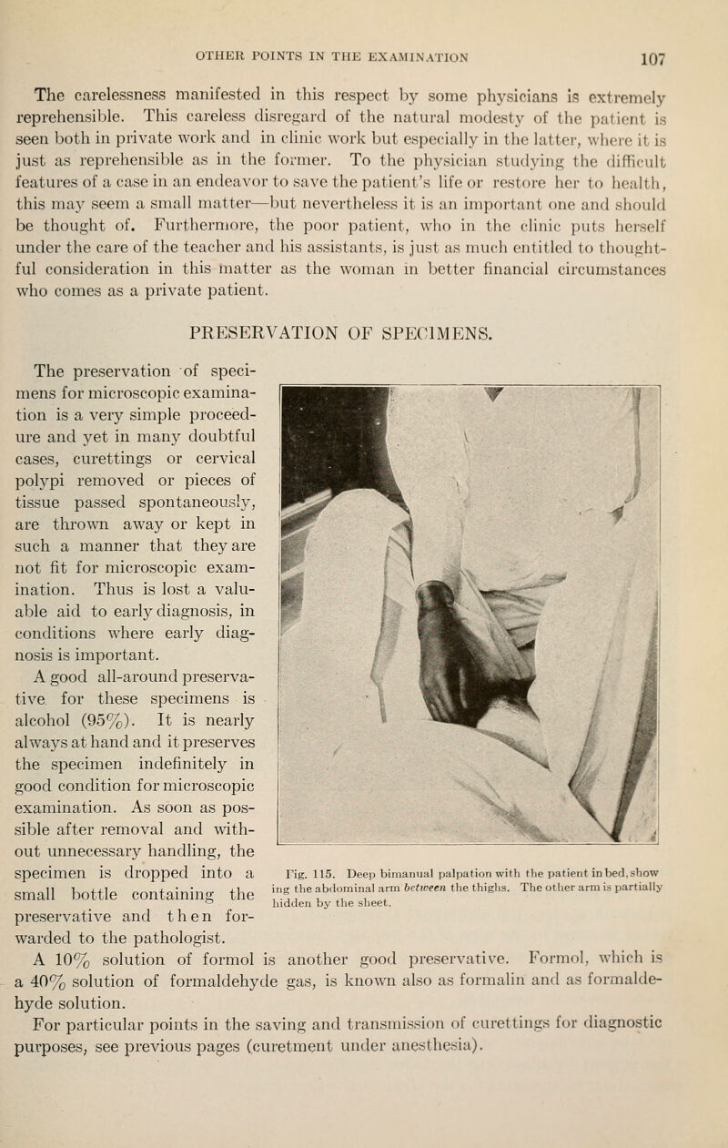 The carelessness manifested in this respect by some physicians Is? extremely reprehensible. This careless disregard of the natural modesty of the patient is seen both in private work and in clinic work but especially in the latter, where it is just as reprehensible as in the former. To the physician studying the difficult features of a case in an endeavor to save the patient's life or restore her to health, this may seem a small matter—but nevertheless it is an important one and should be thought of. Furthermore, the poor patient, who in the clinic puts herself under the care of the teacher and his assistants, is just as much entitled to thought- ful consideration in this matter as the woman m Ijettcr financial circumstances who comes as a private patient. PRESERVATION OF SPECIMENS. The preservation of speci- mens for microscopic examina- tion is a very simple proceed- ure and yet in many doubtful cases, curettings or cervical polypi removed or pieces of tissue passed spontaneously, are thrown away or kept in such a manner that they are not fit for microscopic exam- ination. Thus is lost a valu- able aid to early diagnosis, in conditions where early diag- nosis is important. A good all-around preserva- tive for these specimens is alcohol (95%). It is nearly always at hand and it preserves the specimen indefinitely in good condition for microscopic examination. As soon as pos- sible after removal and with- out unnecessary handling, the specimen is dropped into a small bottle containing the preservative and then for- warded to the pathologist. A 10% solution of formol is another good preservative. Formol, which is a 40% solution of formaldehyde gas, is known also as formalin and as formalde- hyde solution. For particular points in the saving and transmission of curettings for diagnostic purposes, see previous pages (curetment under anesthesia). Fig. 115. Deep bimanual palpation with tlie patient in bed, show ing the abdominal arm bettveen the thighs. The otiier arm is partially hidden by the sheet.