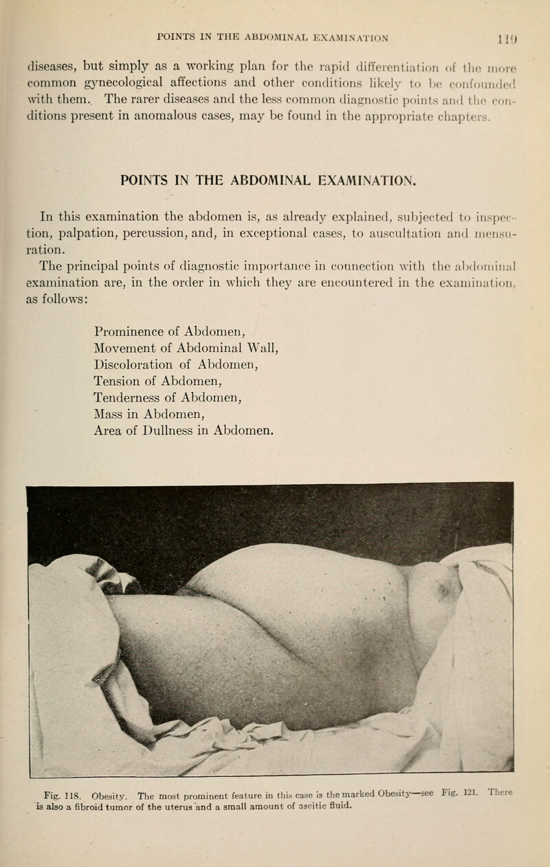 POINTS IN THE ABDOMINAL EXAMINATION H'J diseases, but simply as a working plan for the lapul difTcrentiation of (ho more common gynecological affections and other conditions likely to l)e confcnmded with them. The rarer diseases and the less common diagnostic points and tiio con- ditions present in anomalous cases, may be found in the appropriate chapters. POINTS IN THE ABDOMINAL EXAMINATION. In this examination the abdomen is, as already explained, subjected to inspec- tion, palpation, percussion, and, in exceptional cases, to auscultation and mensu- ration. The principal points of diagnostic importance in connection with the al)doiiiiii;il examination are, in the order in which they are encountered in the examination, as follows: Prominence of Abdomen, Movement of Abdominal Wall, Discoloration of Abdomen, Tension of Abdomen, Tenderness of Abdomen, Mass in Abdomen, Area of Dullness in Abdomen. Fig. 118. Obesity. The most prominent feature in thib case is the marked Obesity—see Fig. 121. There is also a fibroid tumor of the uterus and a small amount of ascitic fluid.